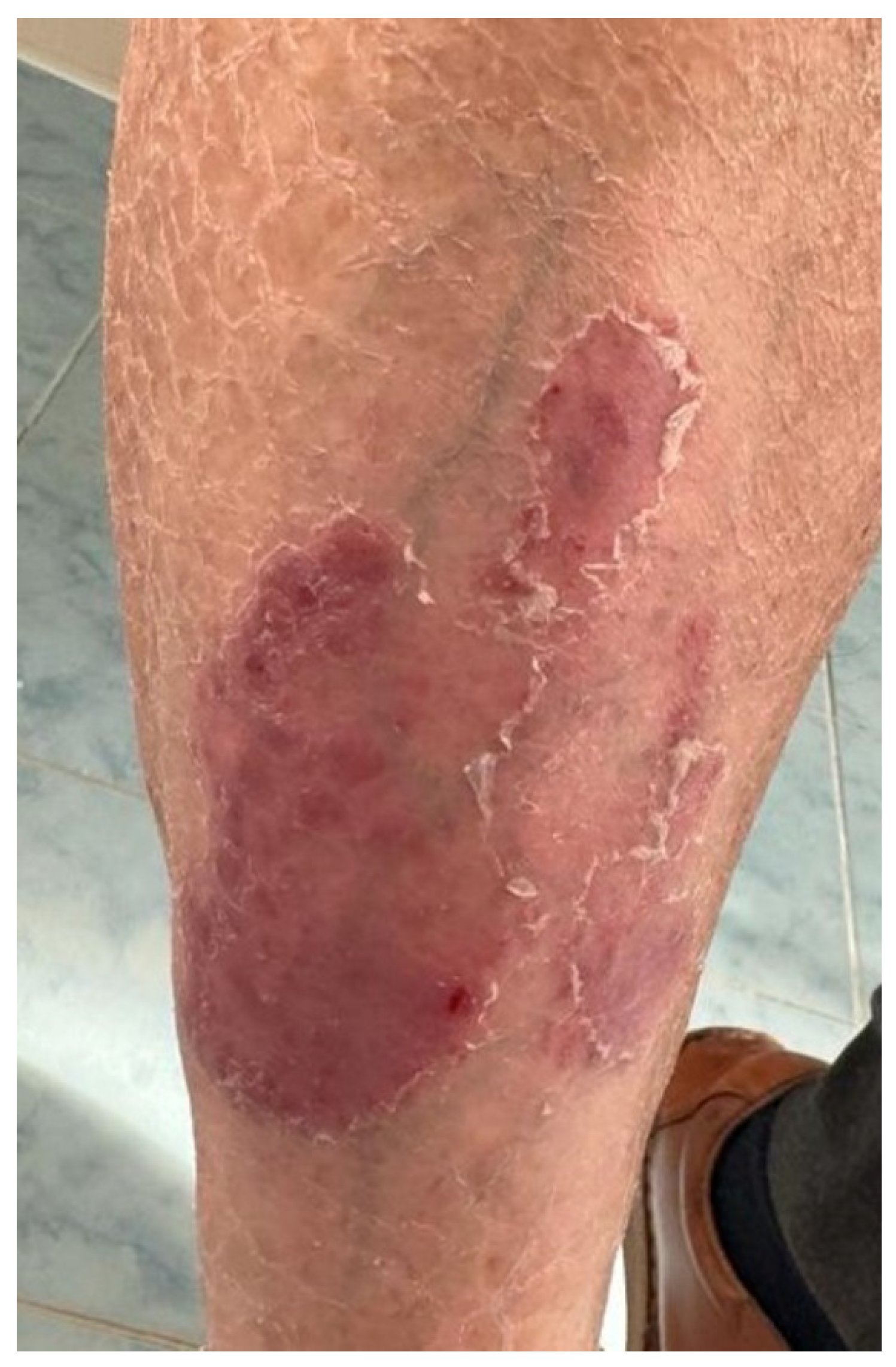 Medicina 60 00373 g004