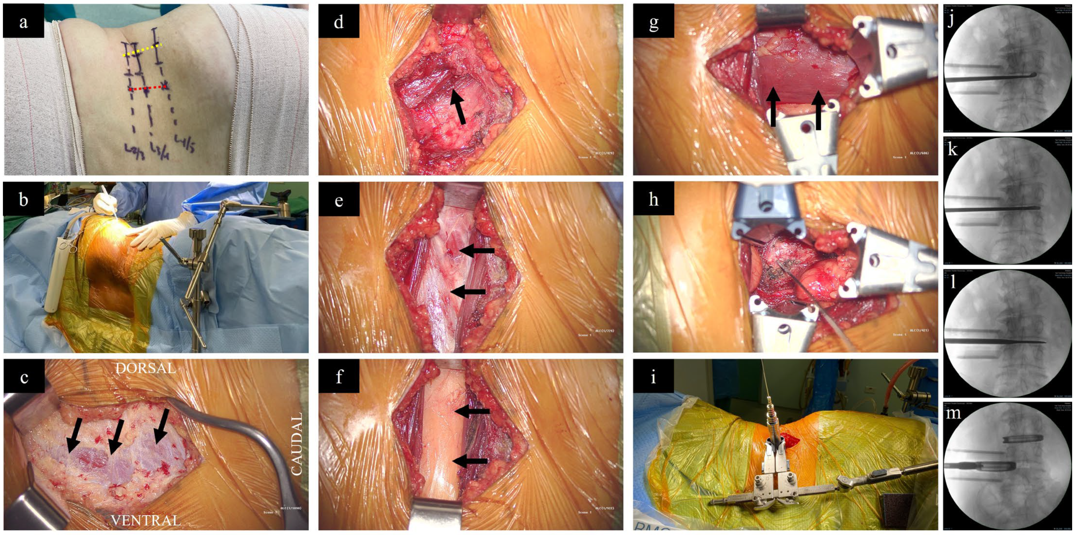 Medicina 60 00378 g002
