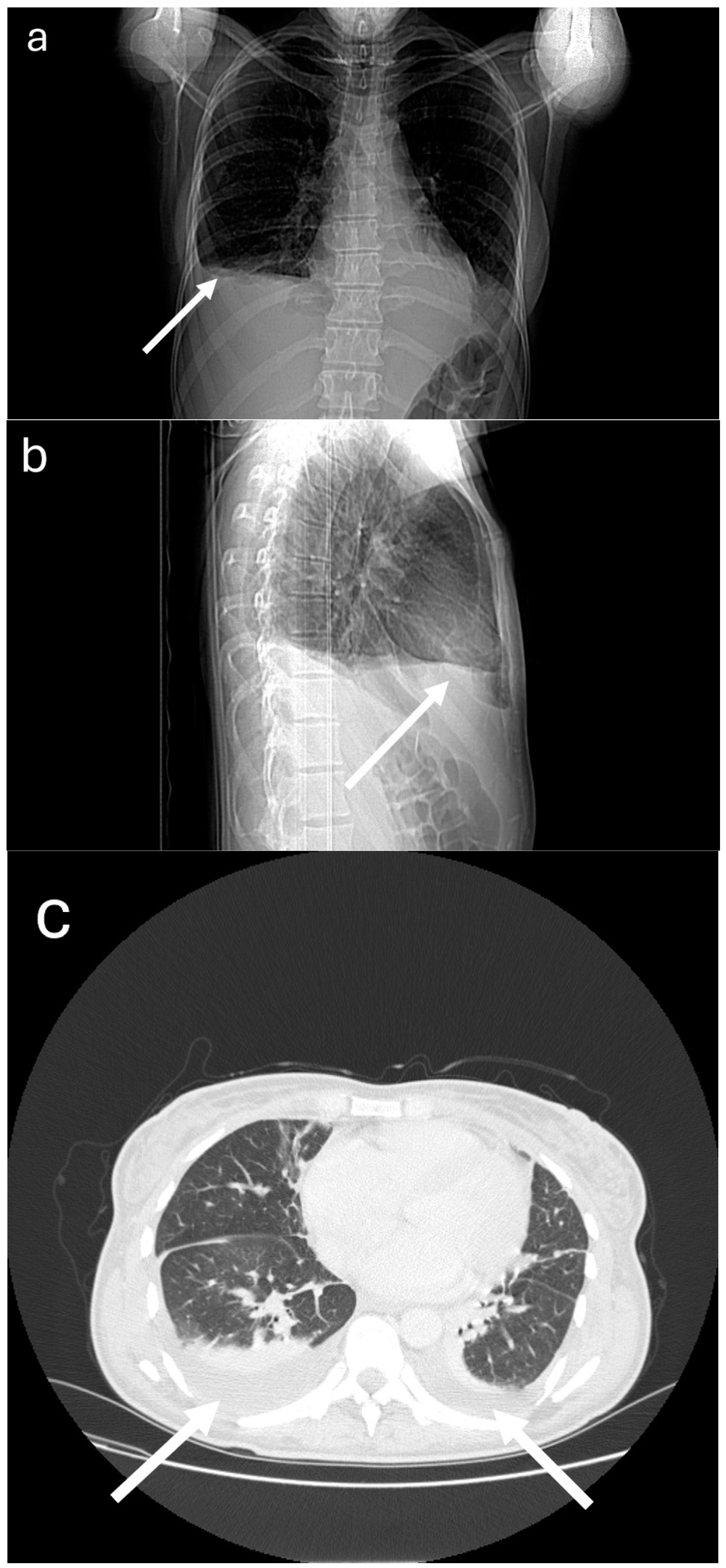 Medicina 60 00392 g001