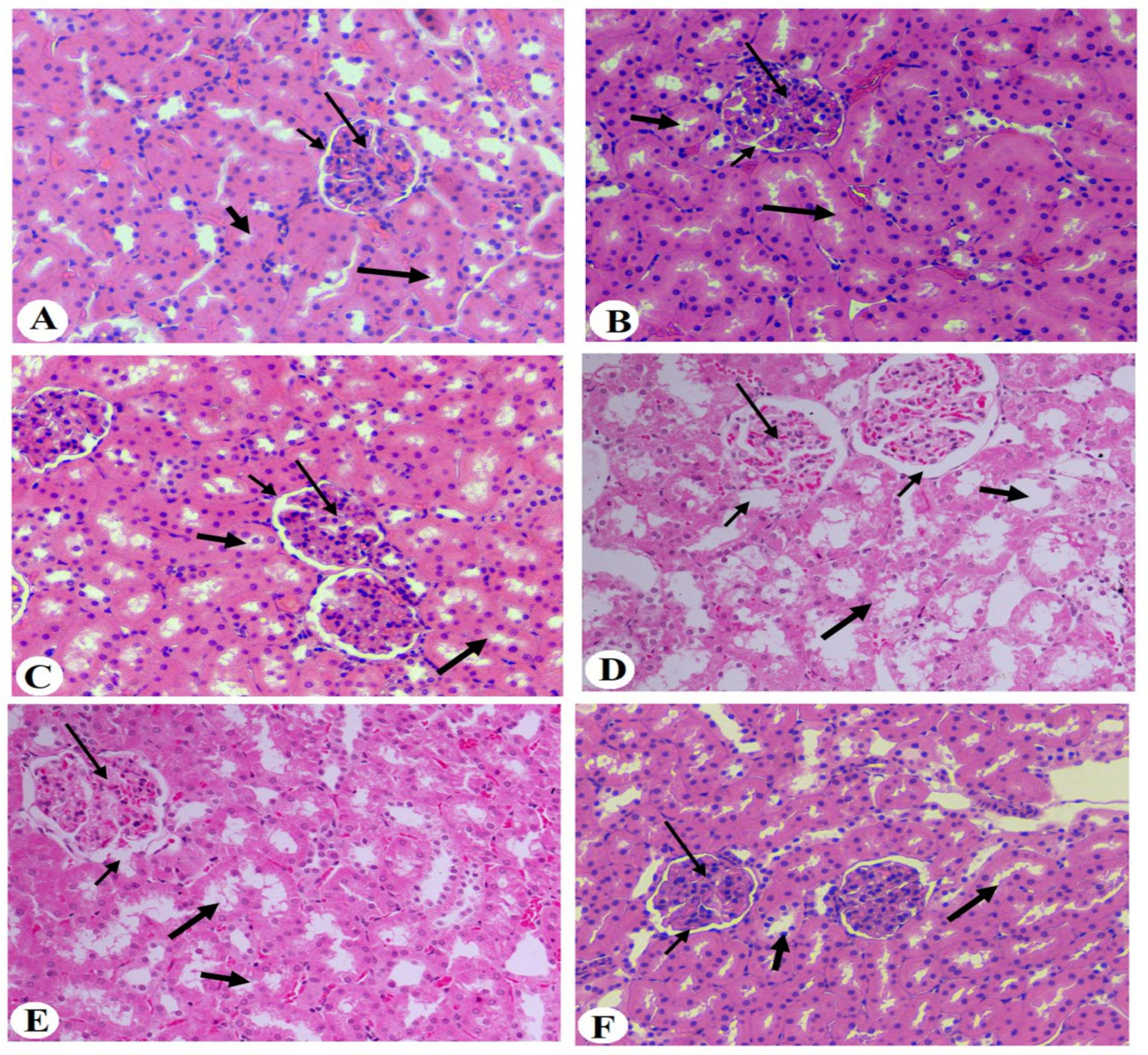Medicina 60 00394 g005