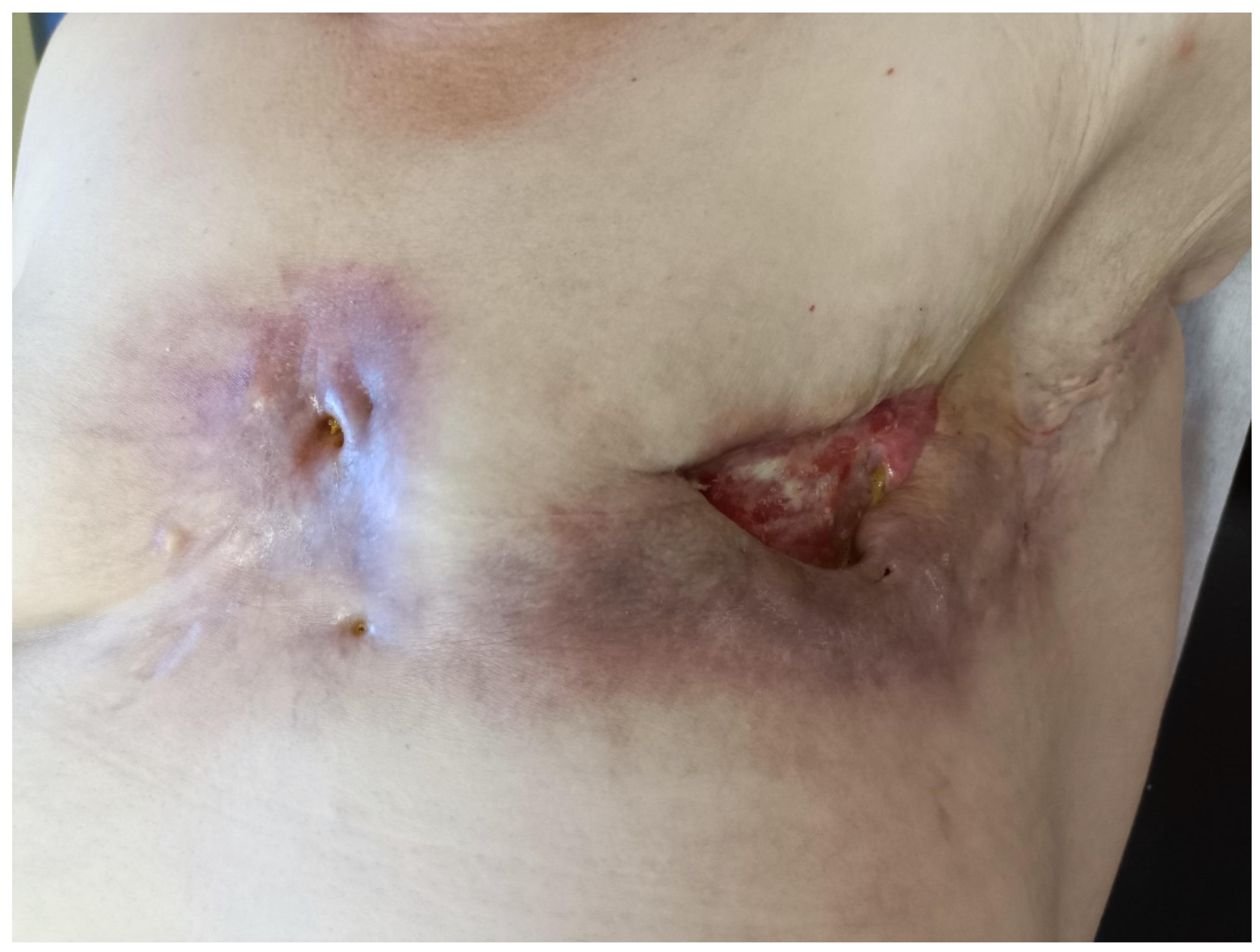 Medicina 60 00399 g001