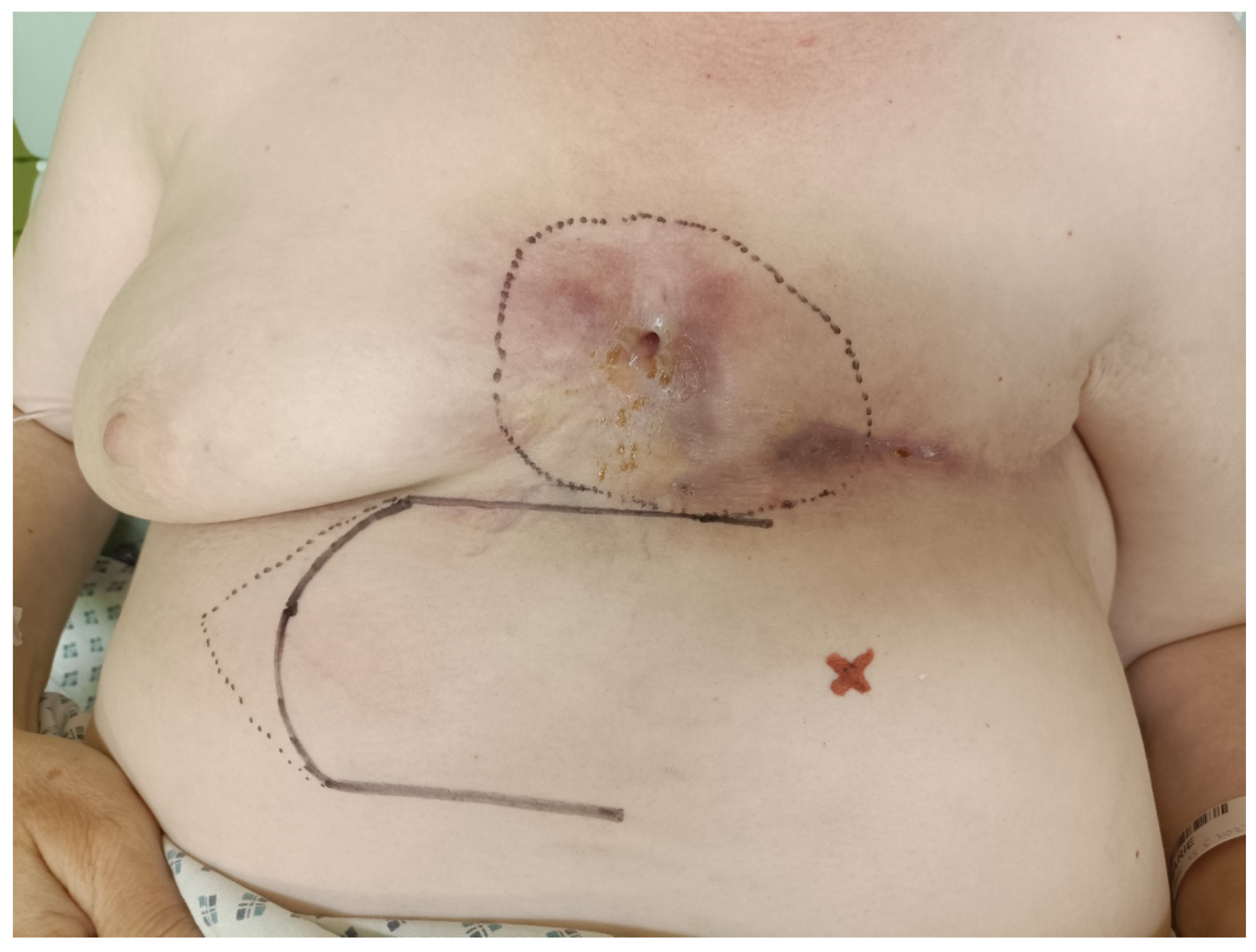 Medicina 60 00399 g003