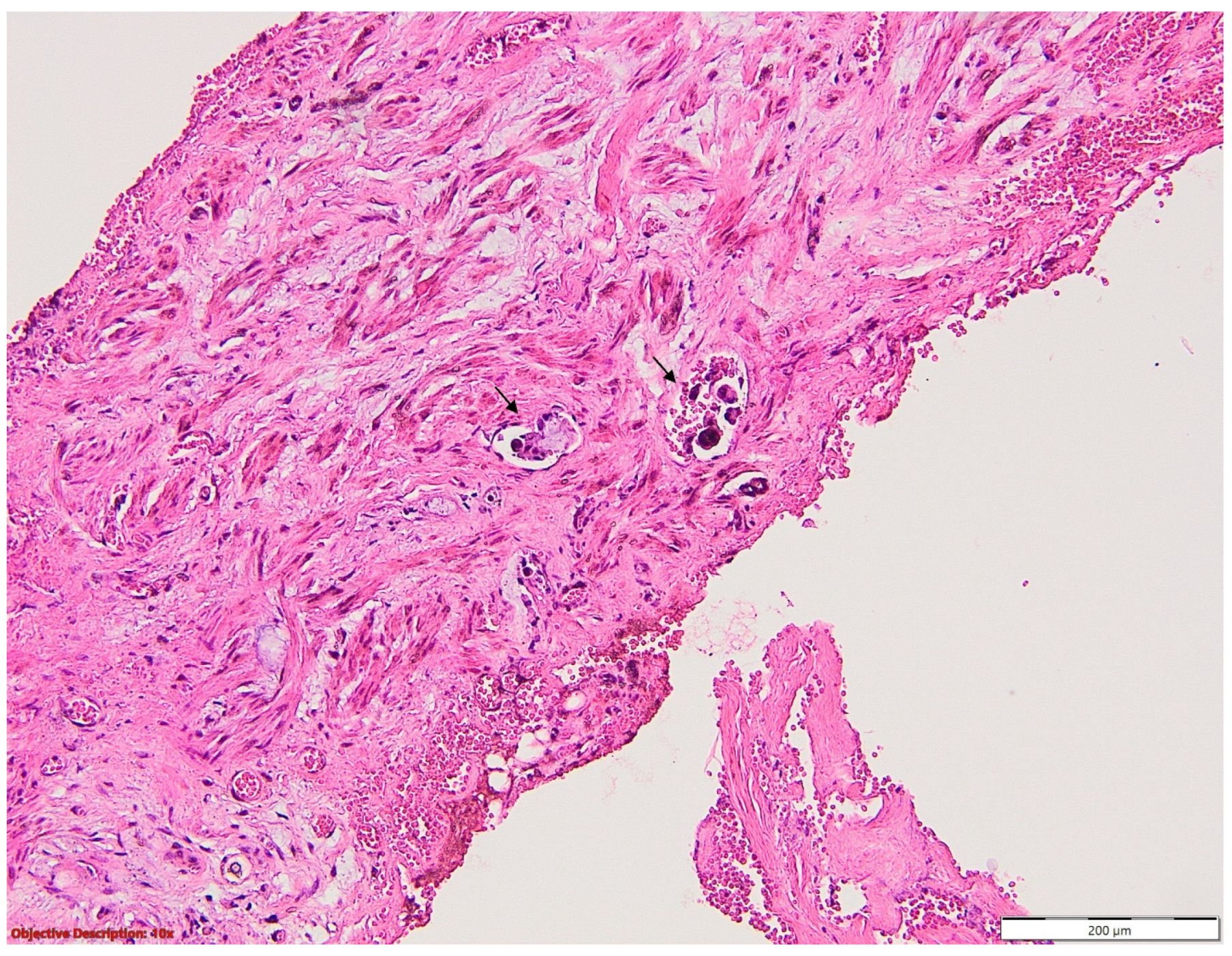 Medicina 60 00415 g005