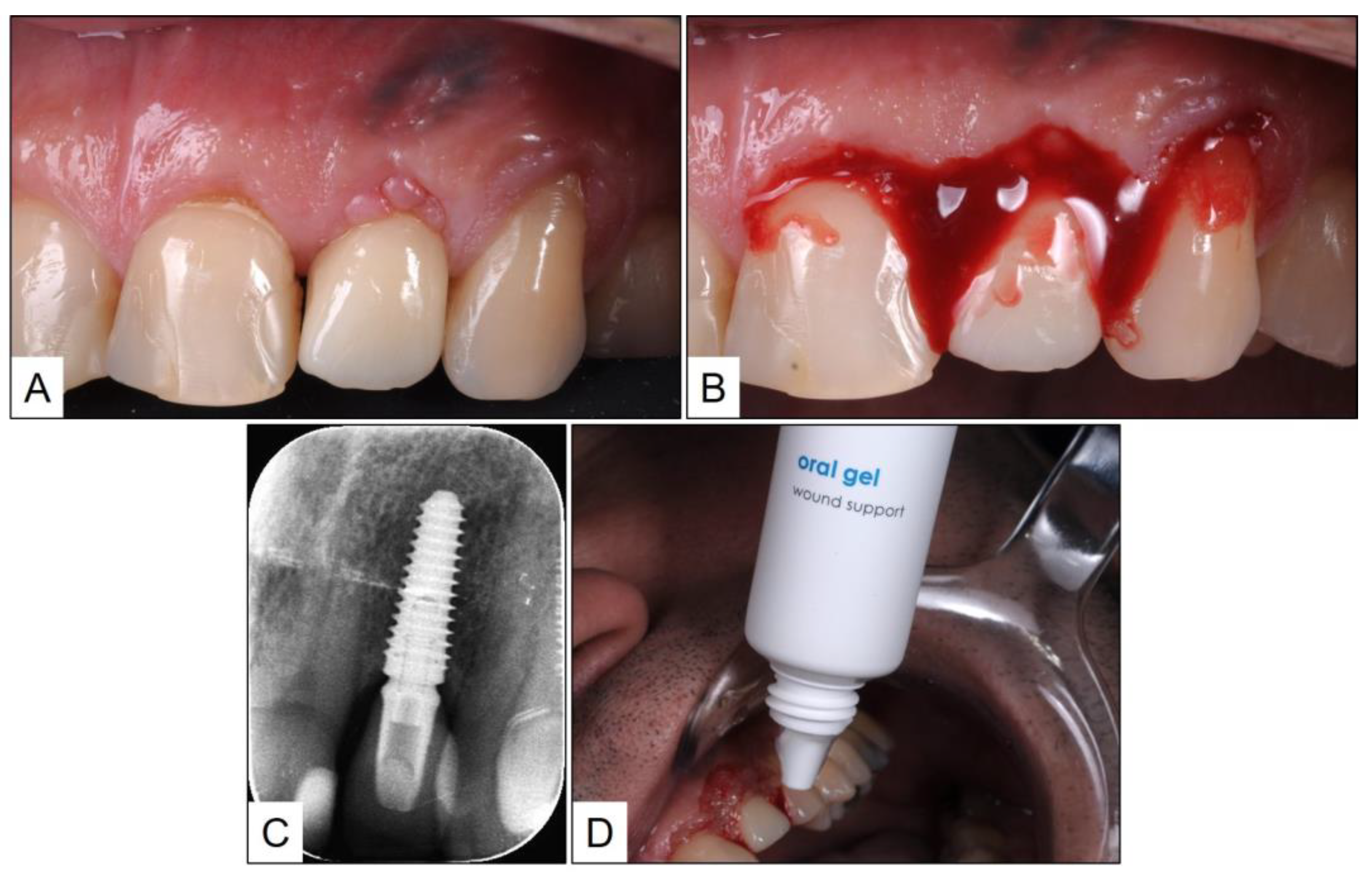 Medicina 60 00447 g002