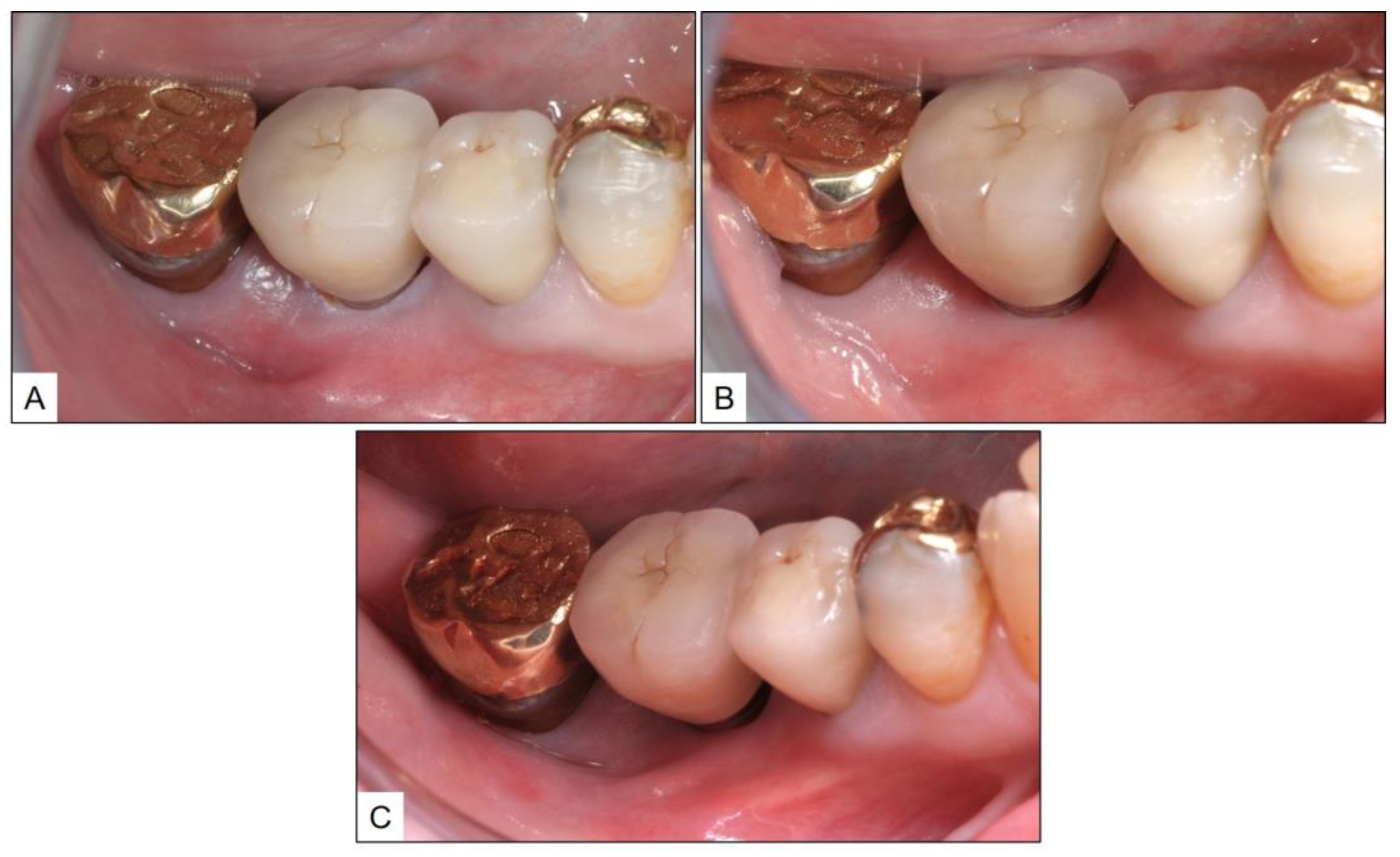 Medicina 60 00447 g005