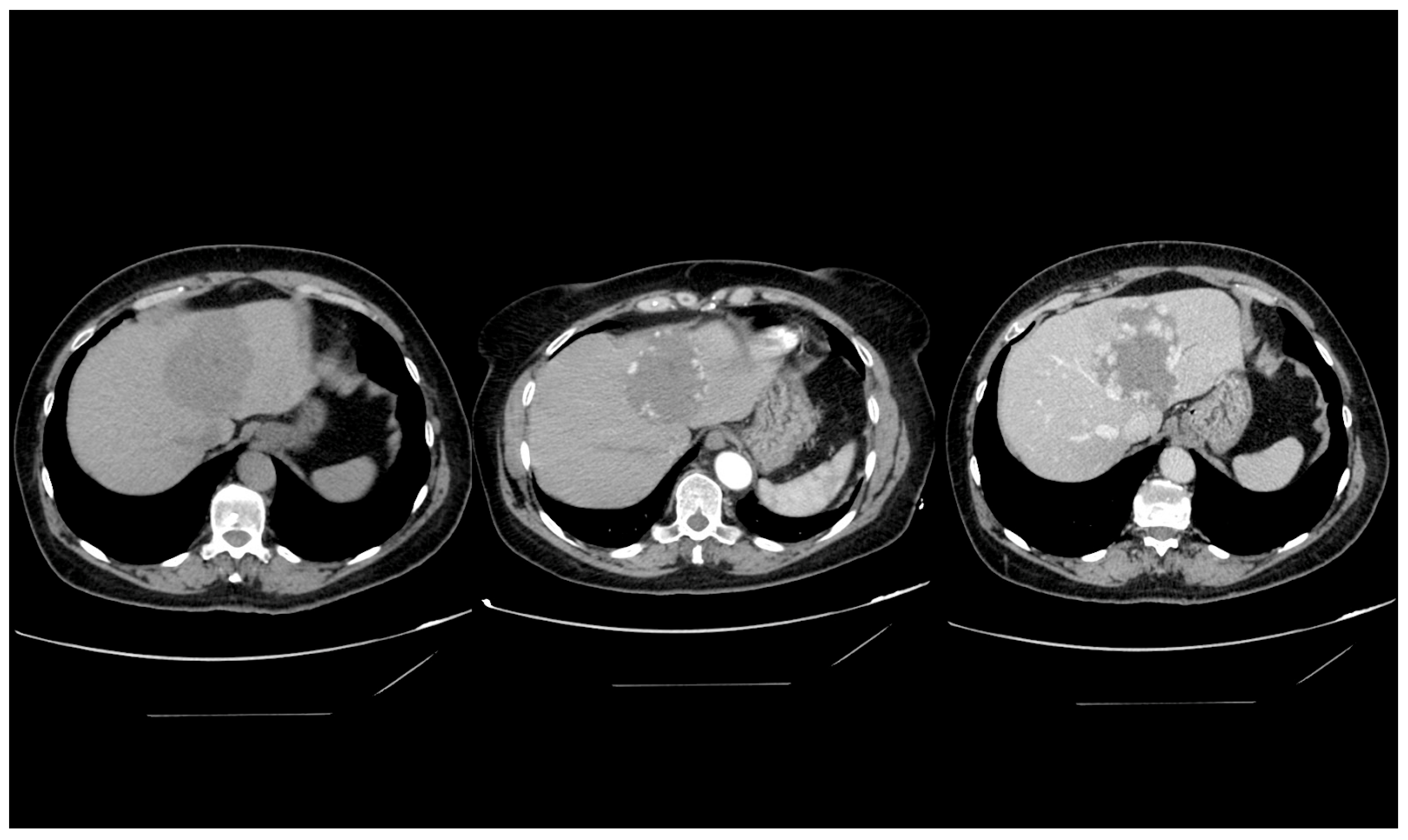 Medicina 60 00449 g002
