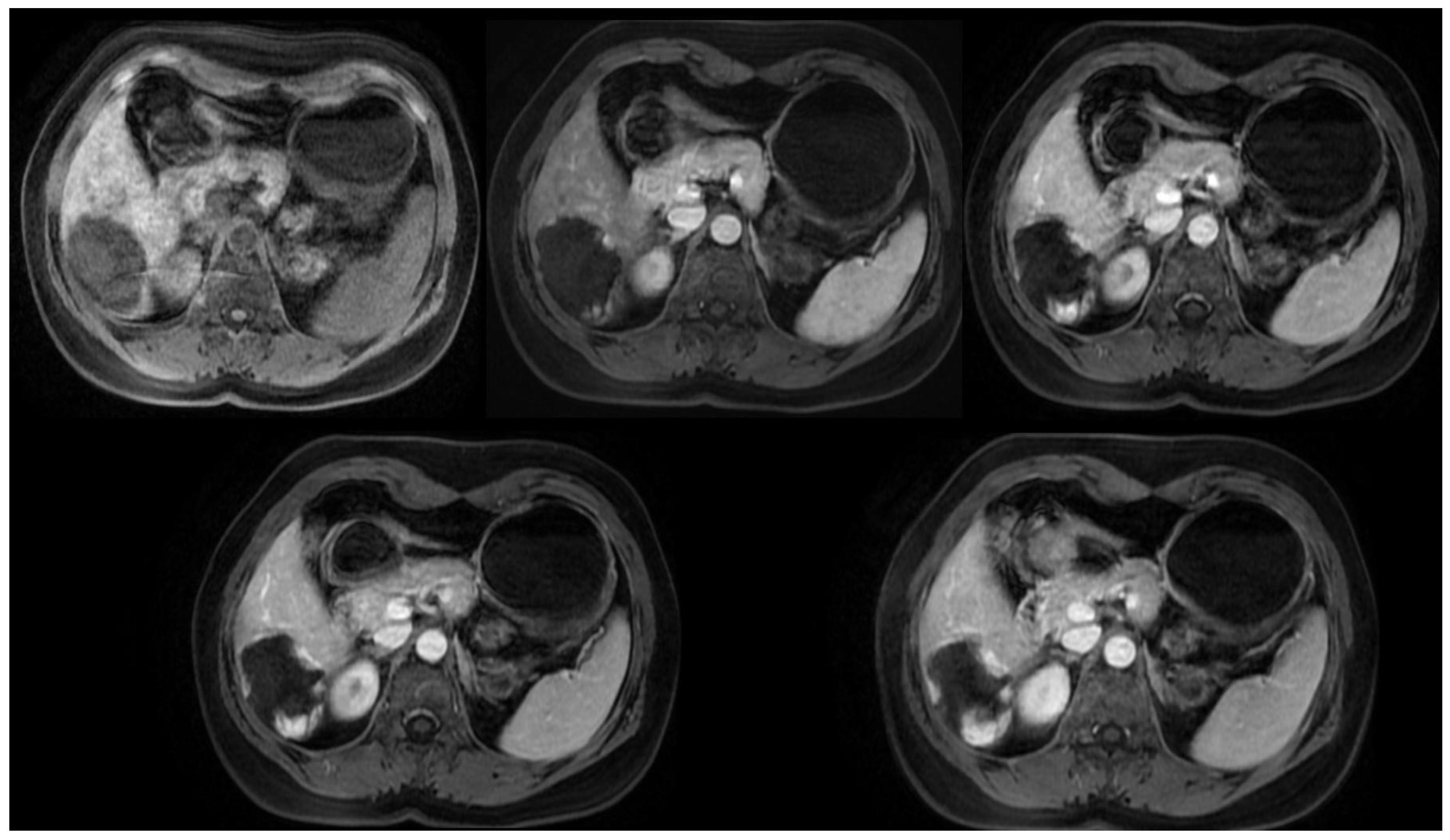 Medicina 60 00449 g003