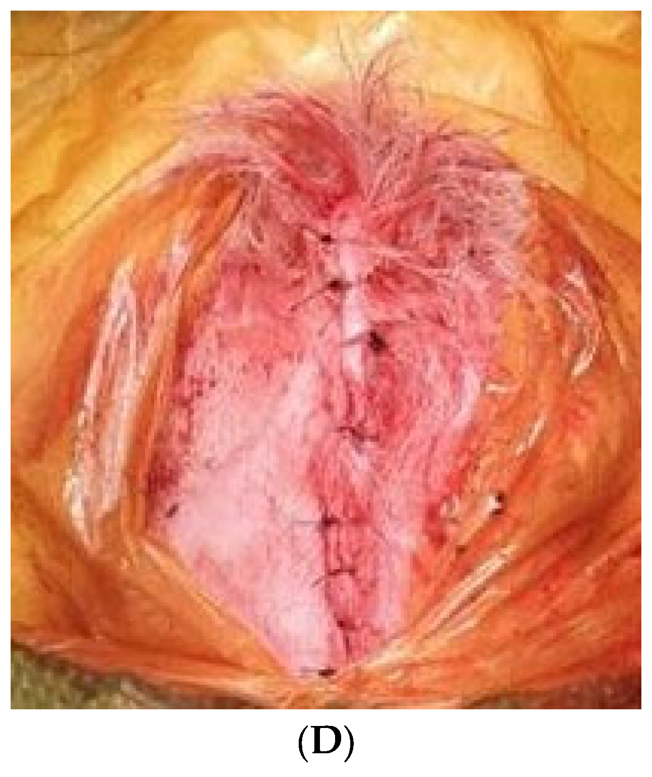 Medicina 60 00451 g001b