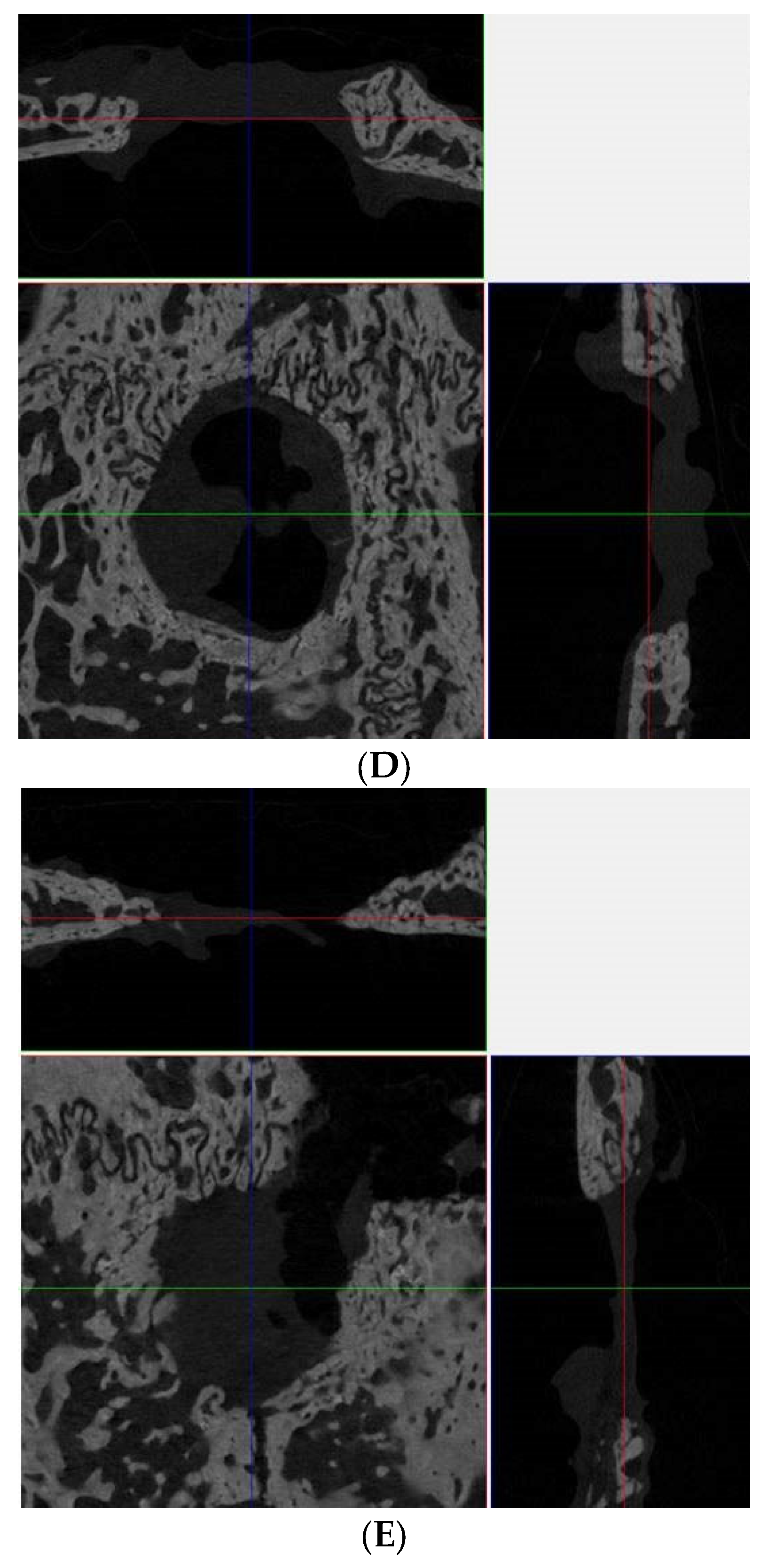 Medicina 60 00451 g003b