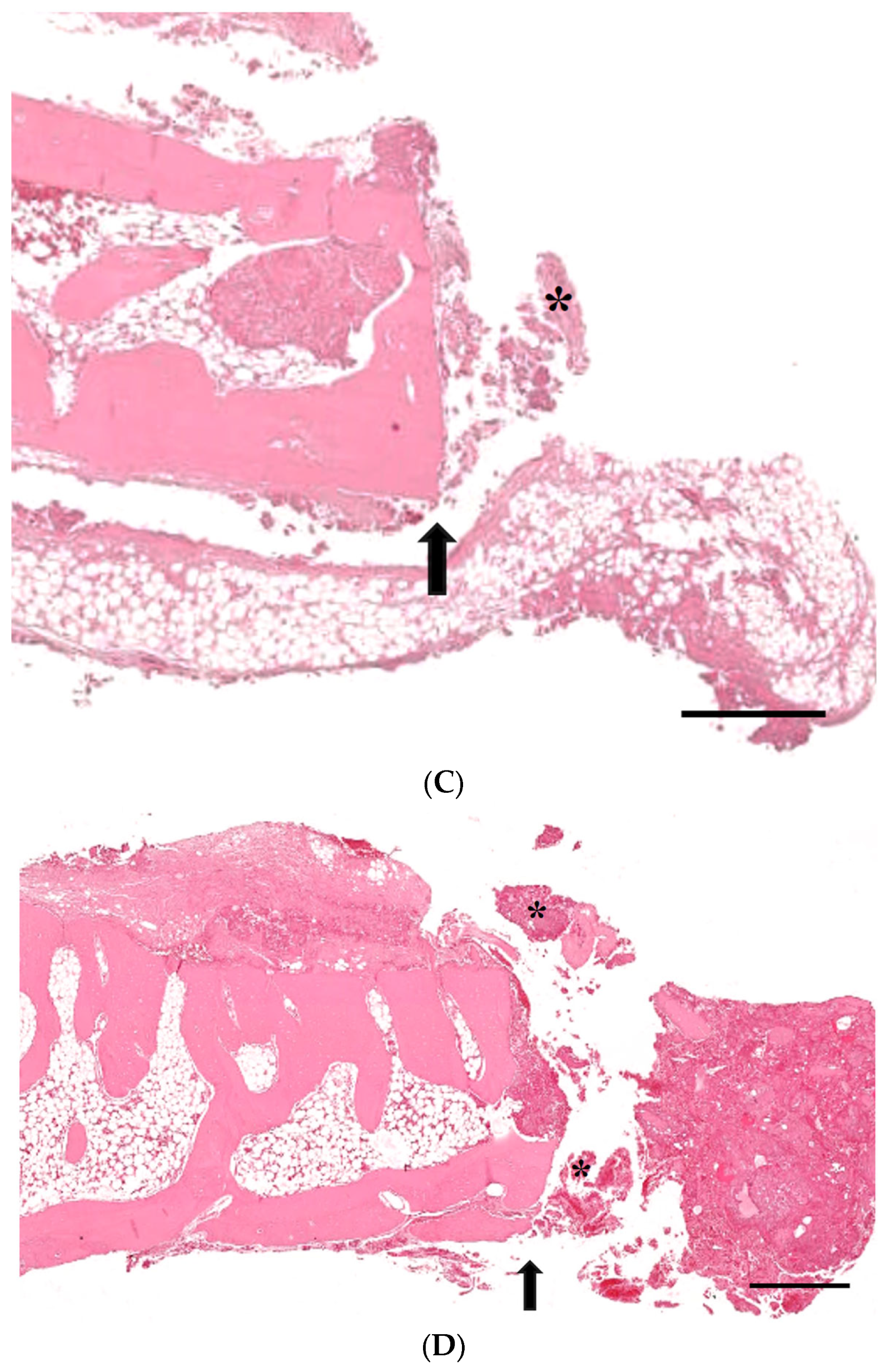 Medicina 60 00451 g005b