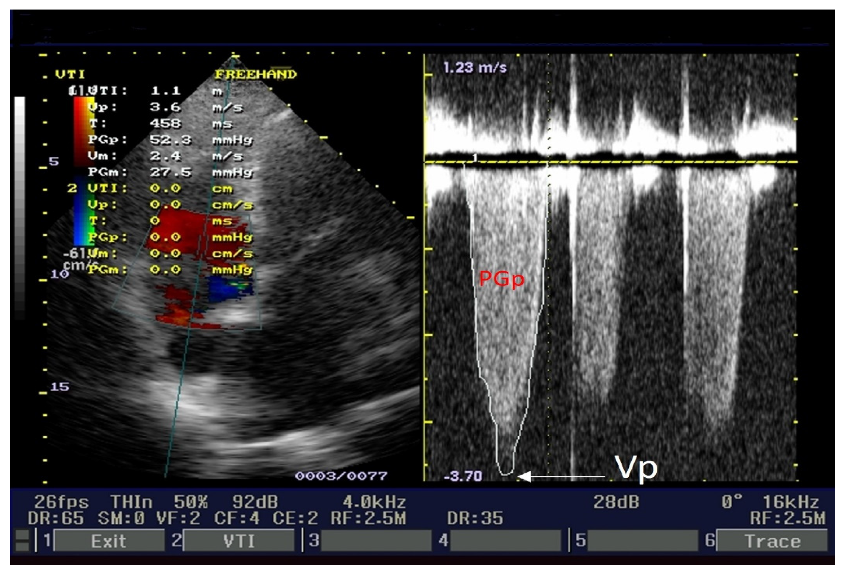 Medicina 60 00456 g005