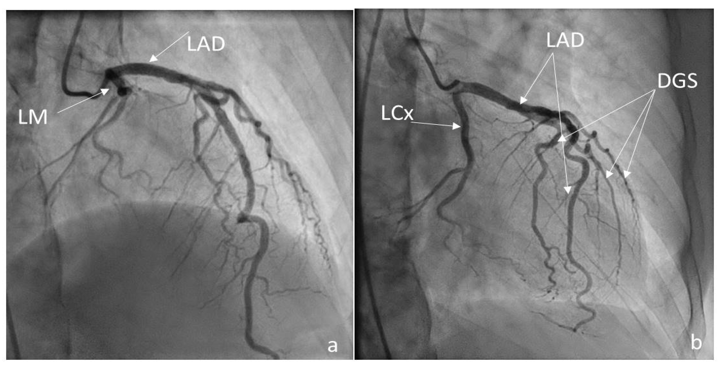 Medicina 60 00456 g006
