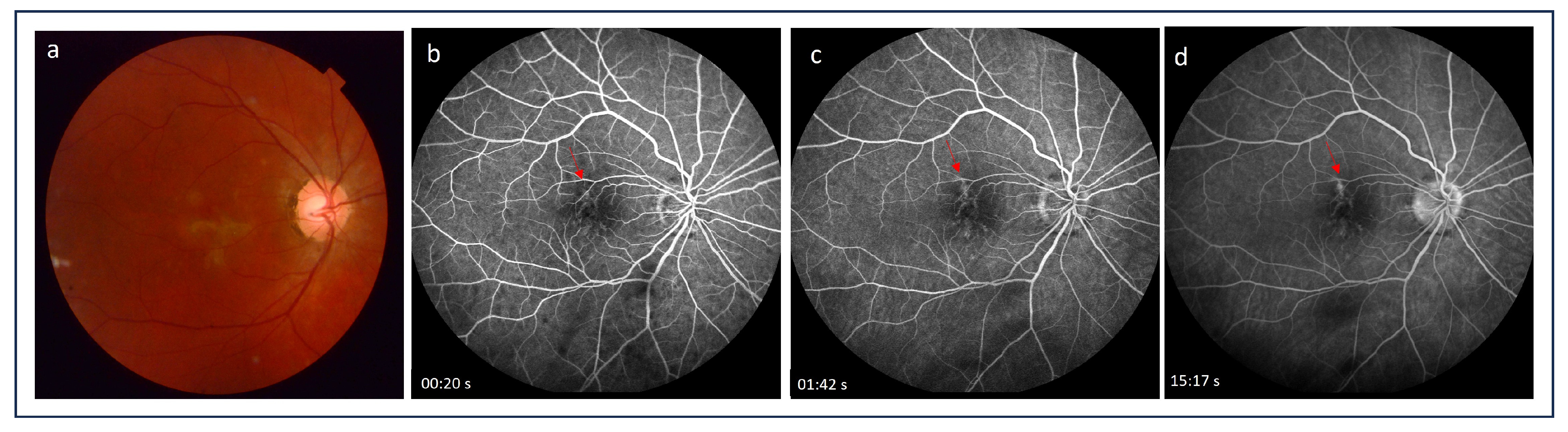 Medicina 60 00465 g002