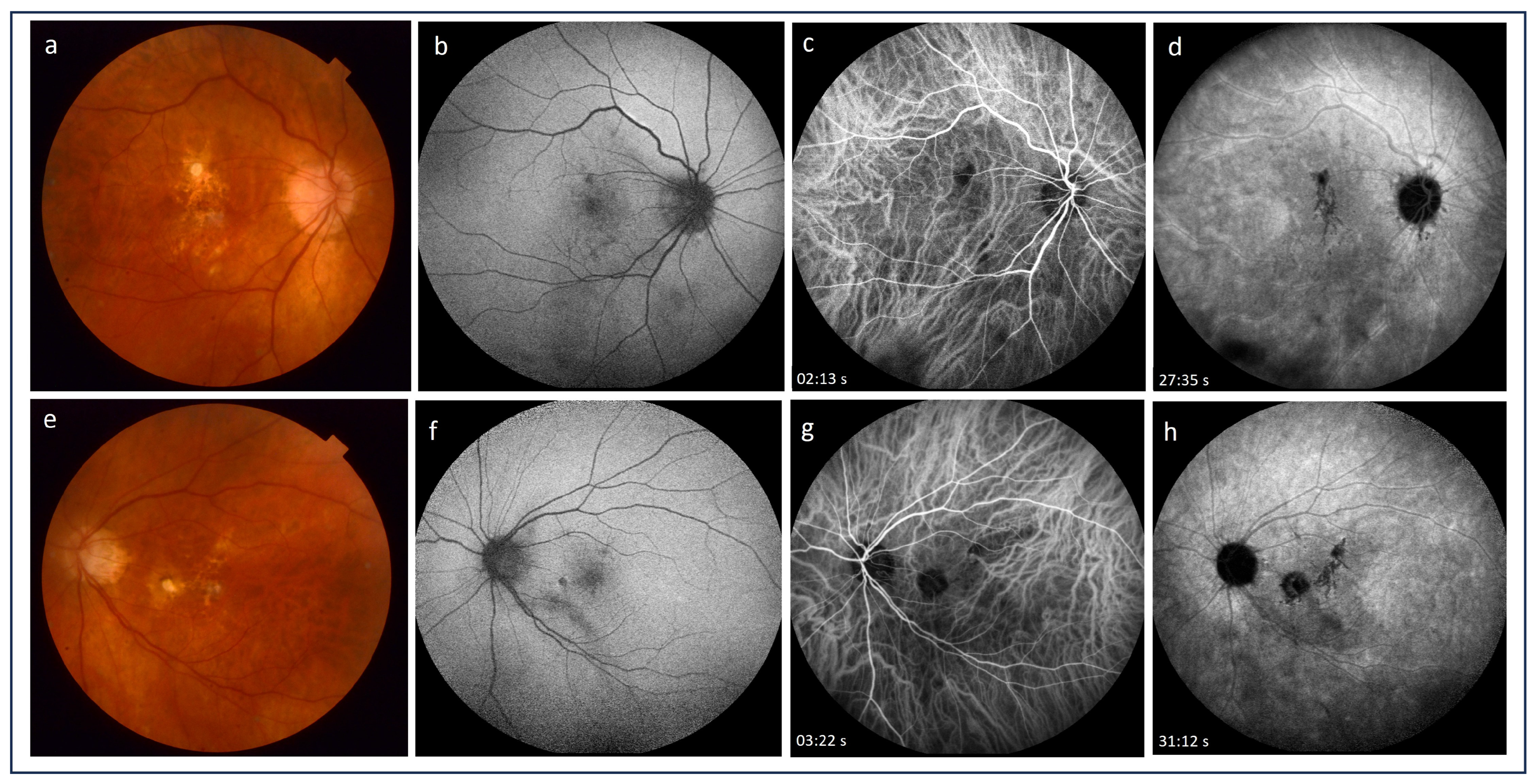 Medicina 60 00465 g004