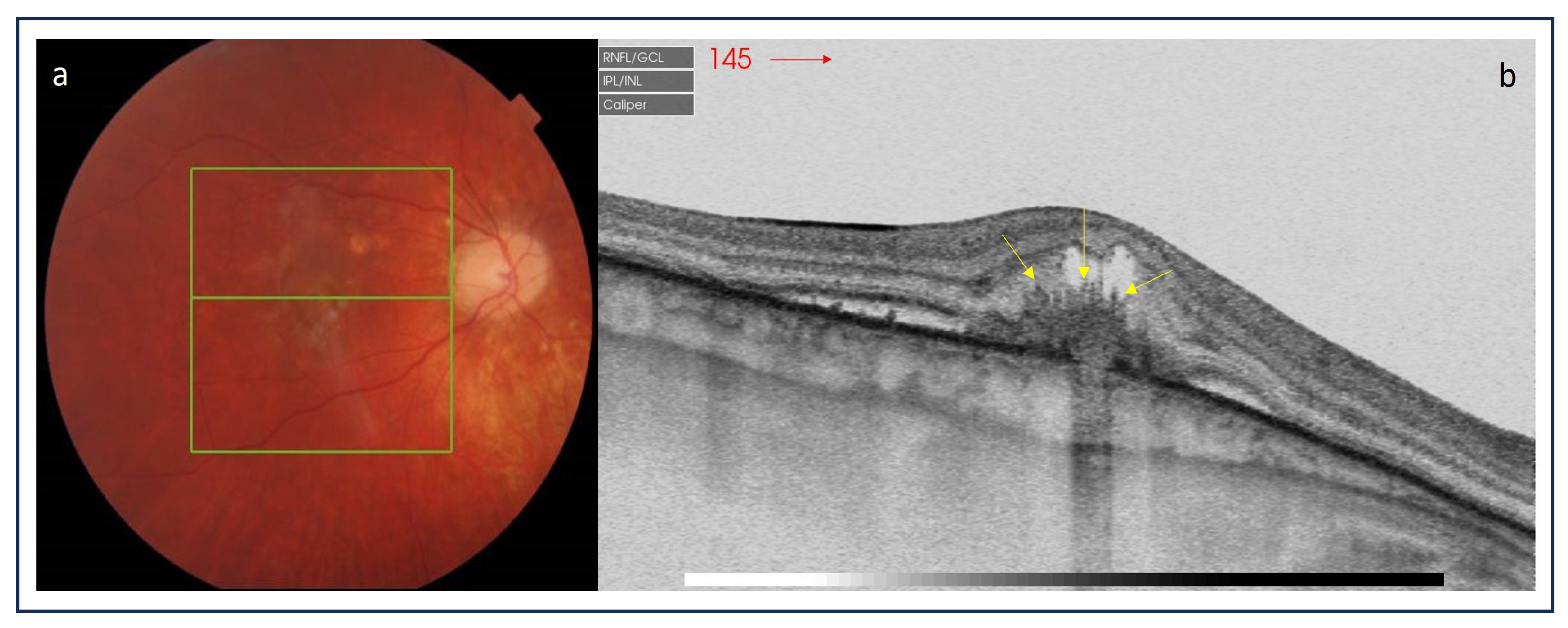 Medicina 60 00465 g005
