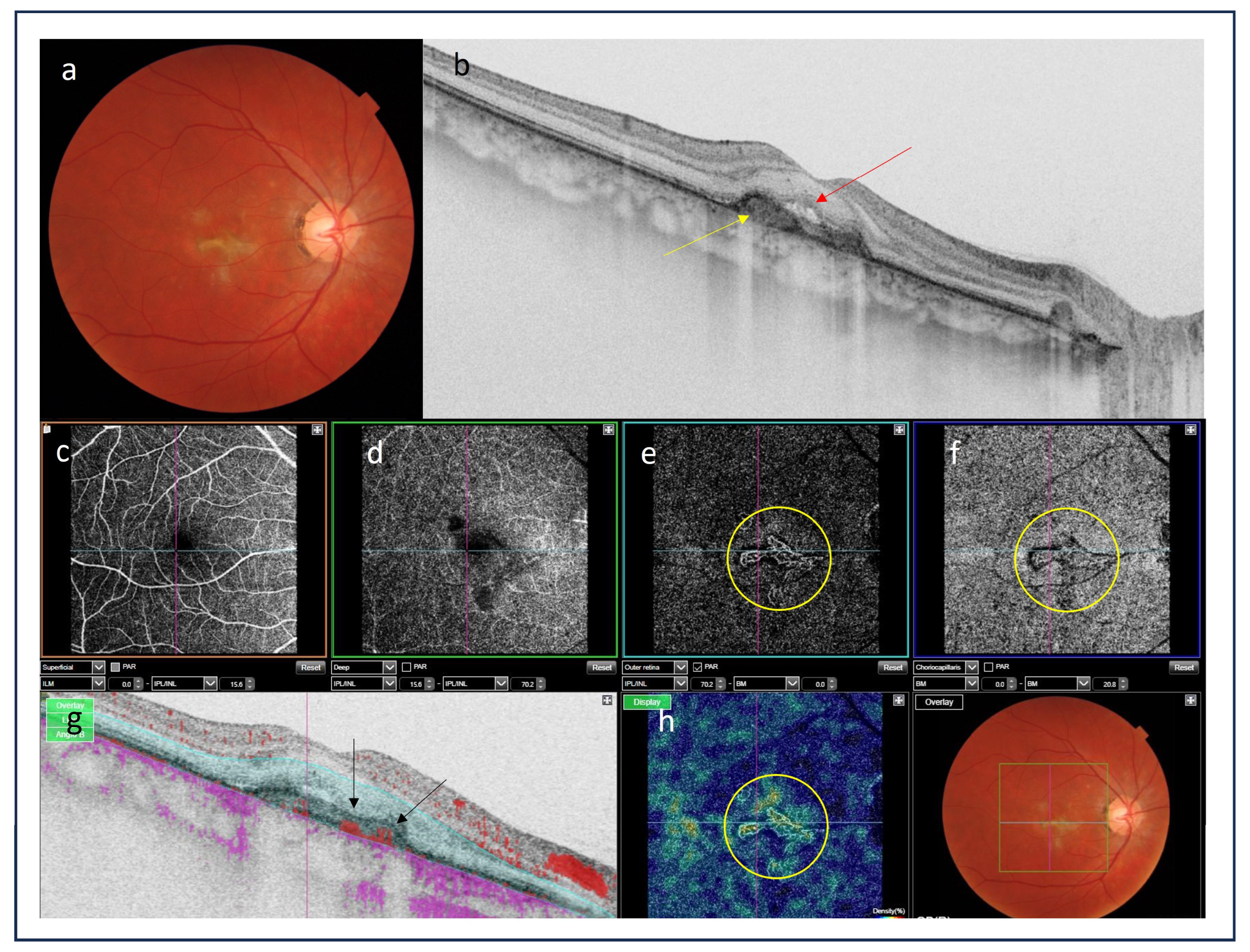 Medicina 60 00465 g006