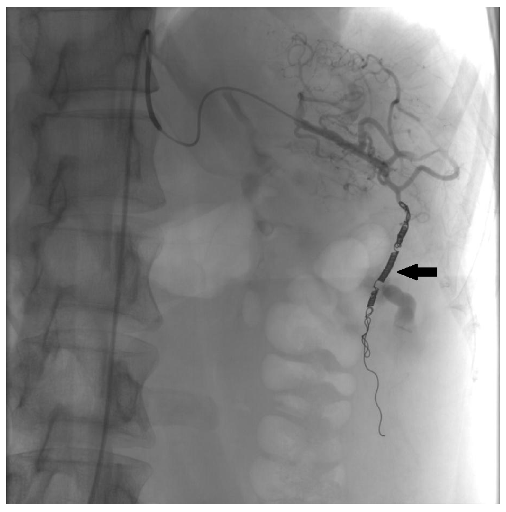 Medicina 60 00470 g003