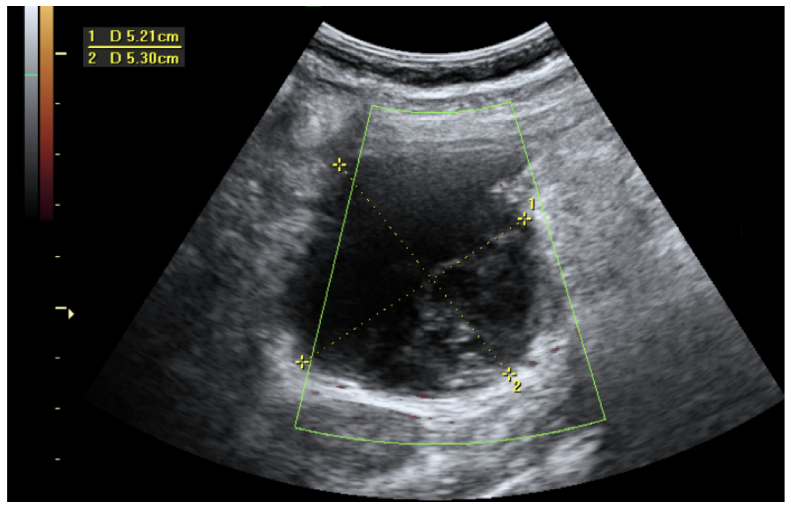Medicina 60 00470 g004
