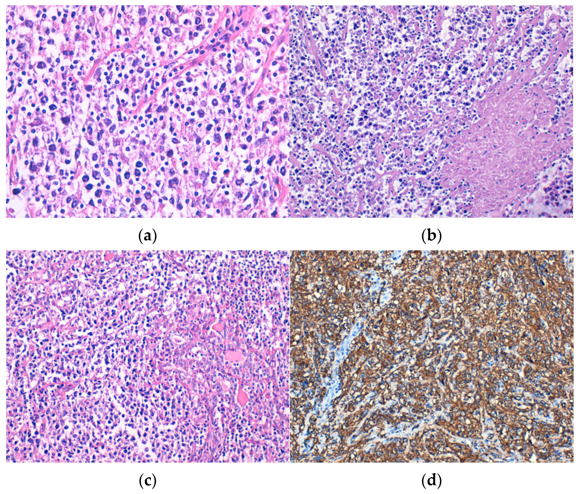 Medicina 60 00476 g001