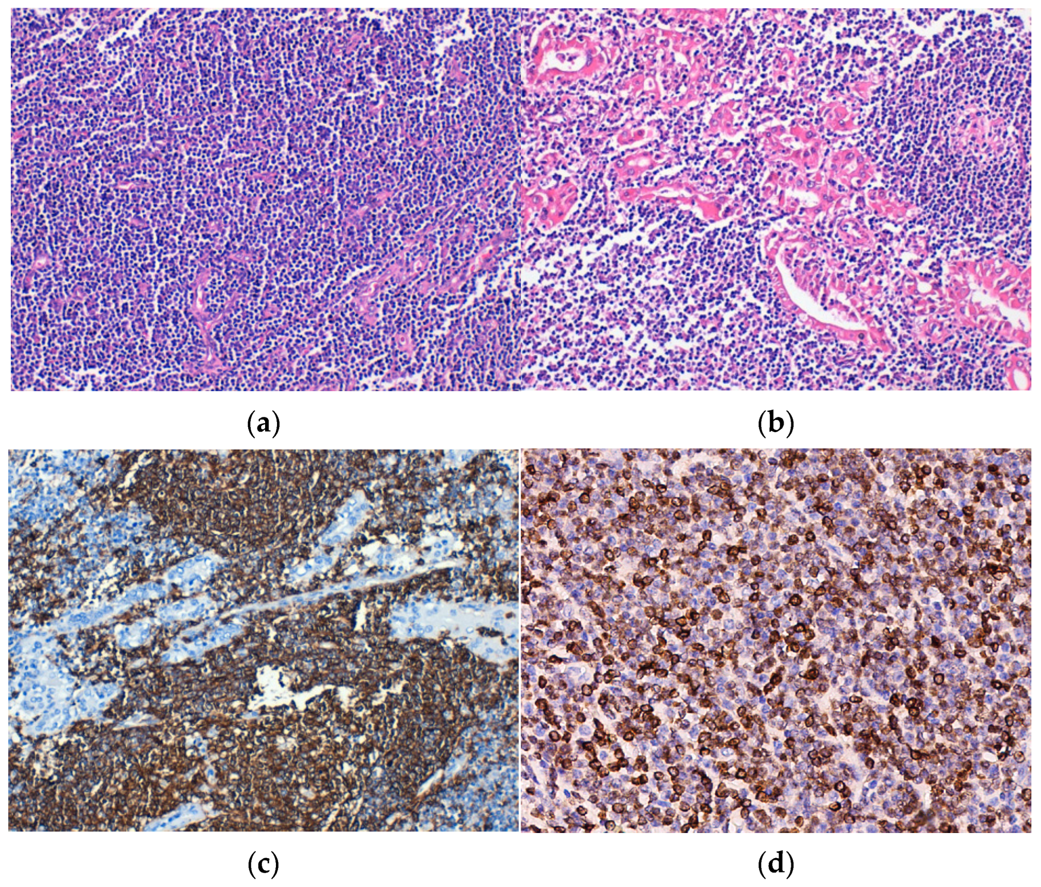 Medicina 60 00476 g002