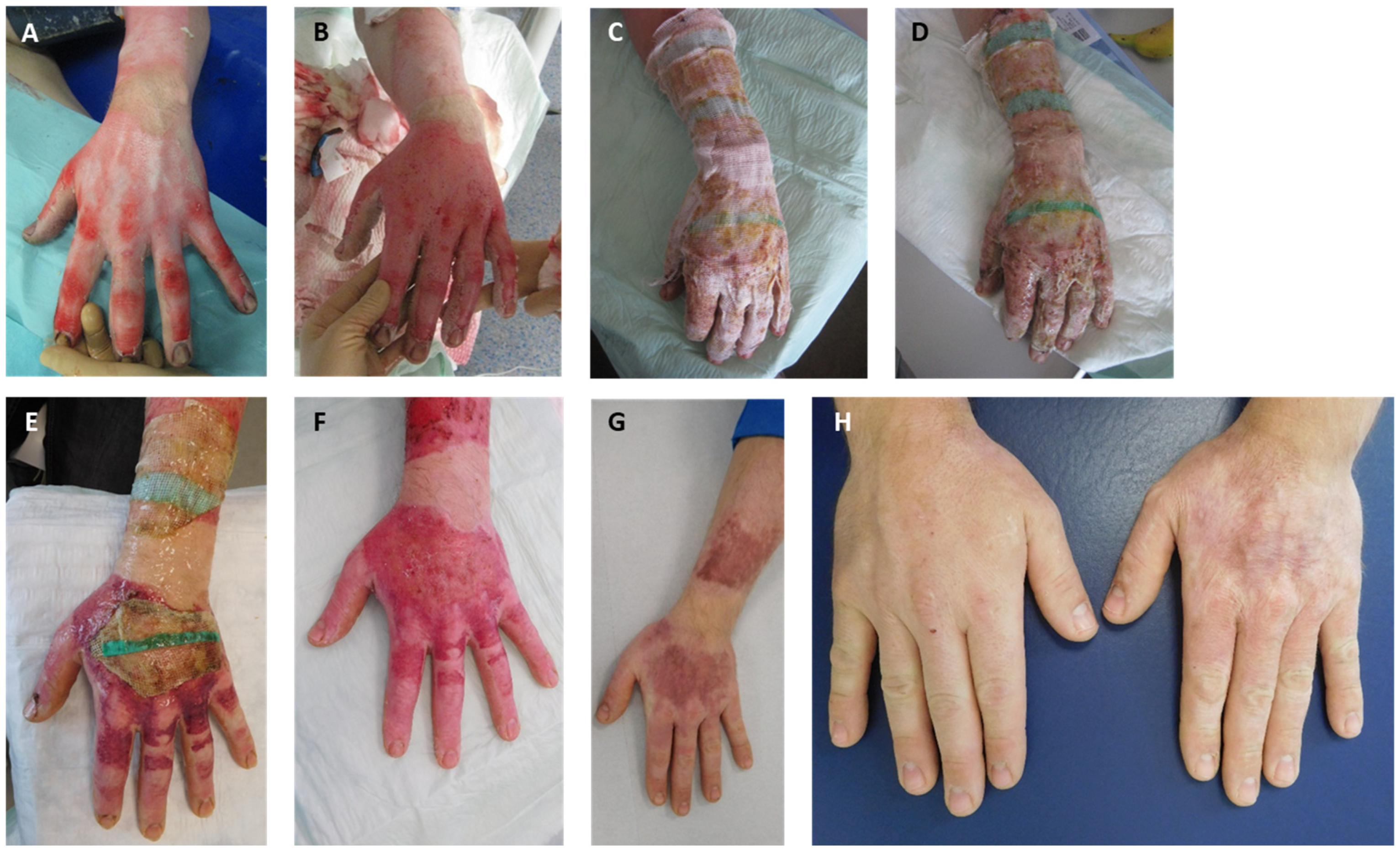 Medicina 60 00481 g004