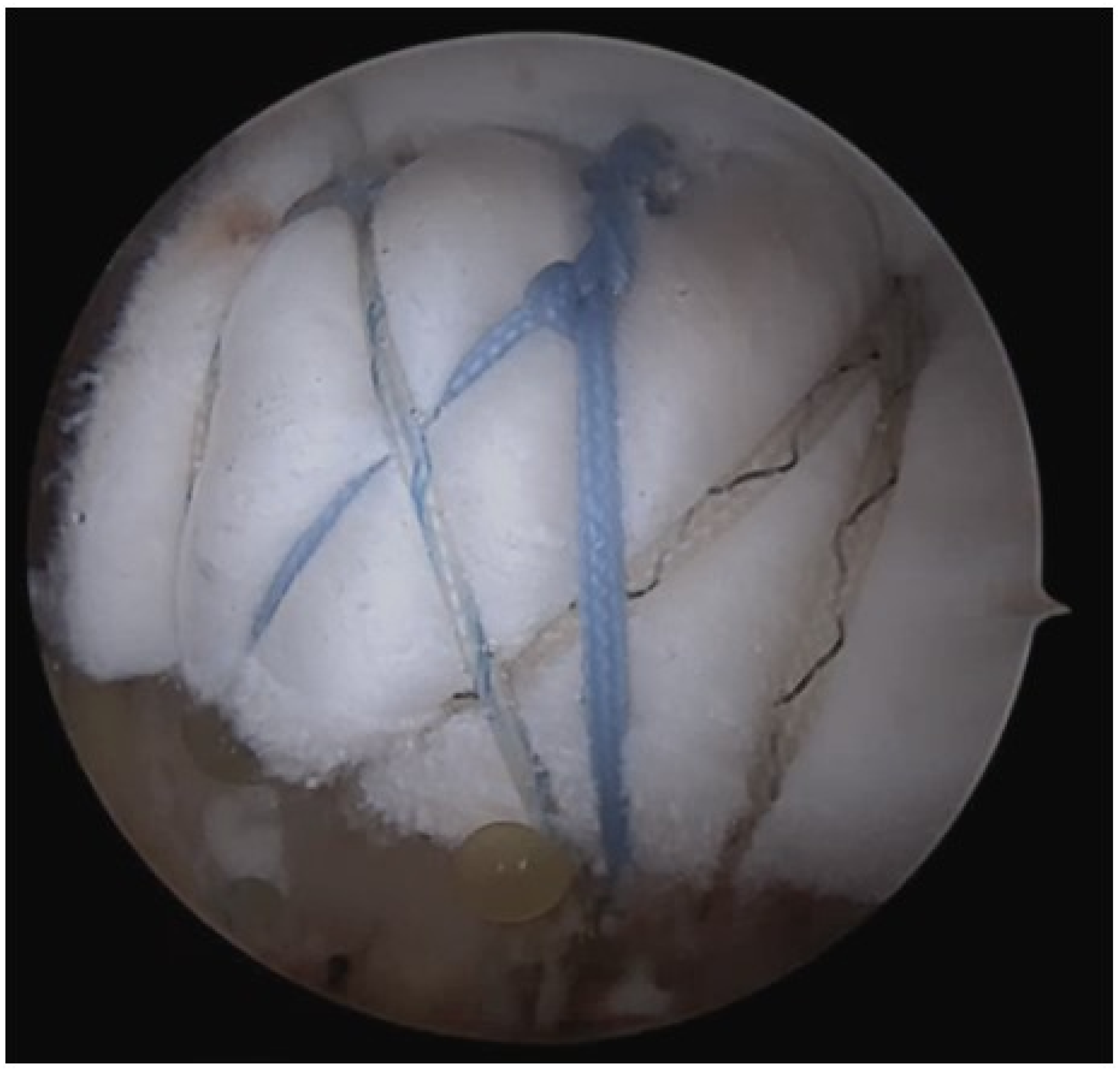 Medicina 60 00484 g002