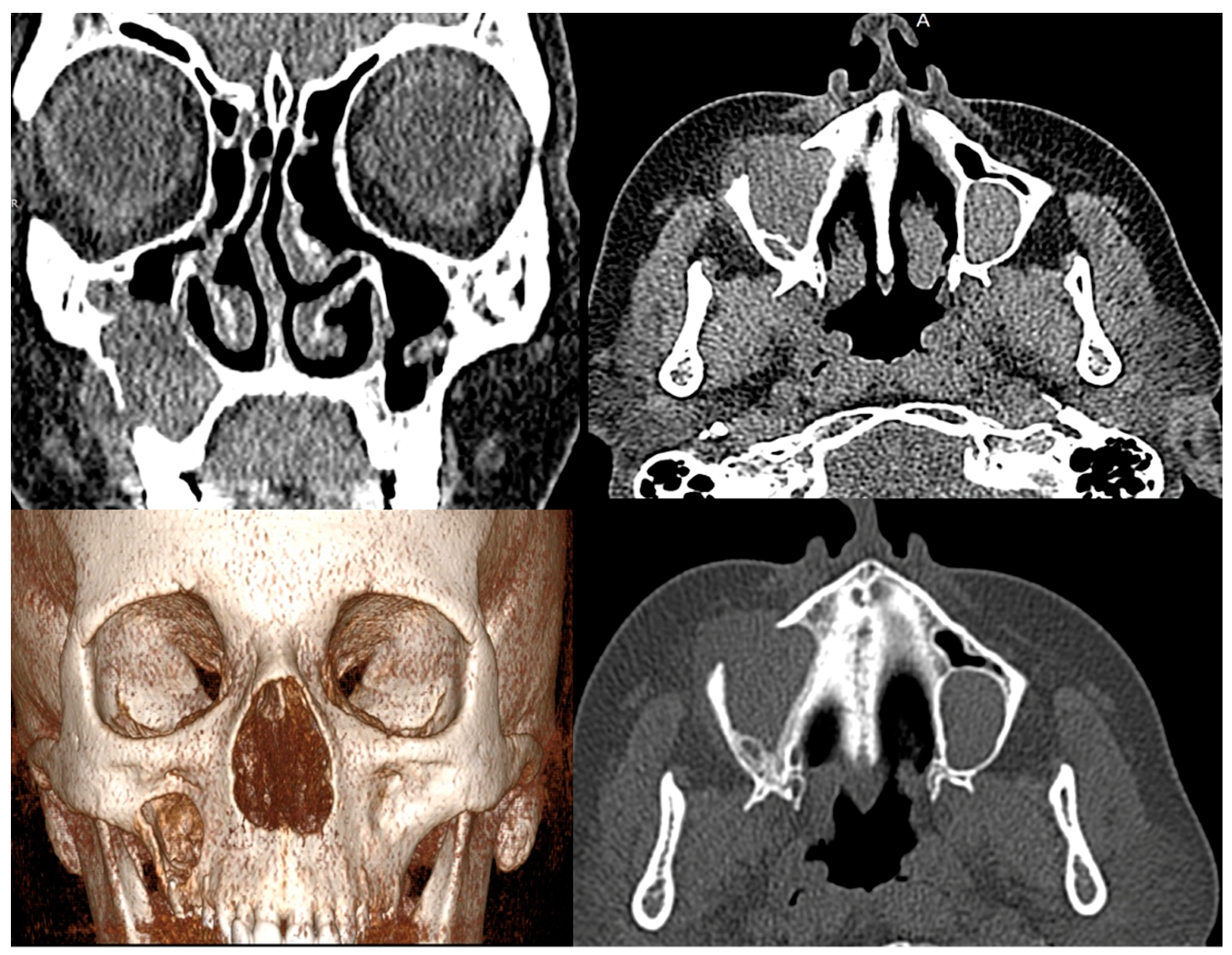 Medicina 60 00496 g001