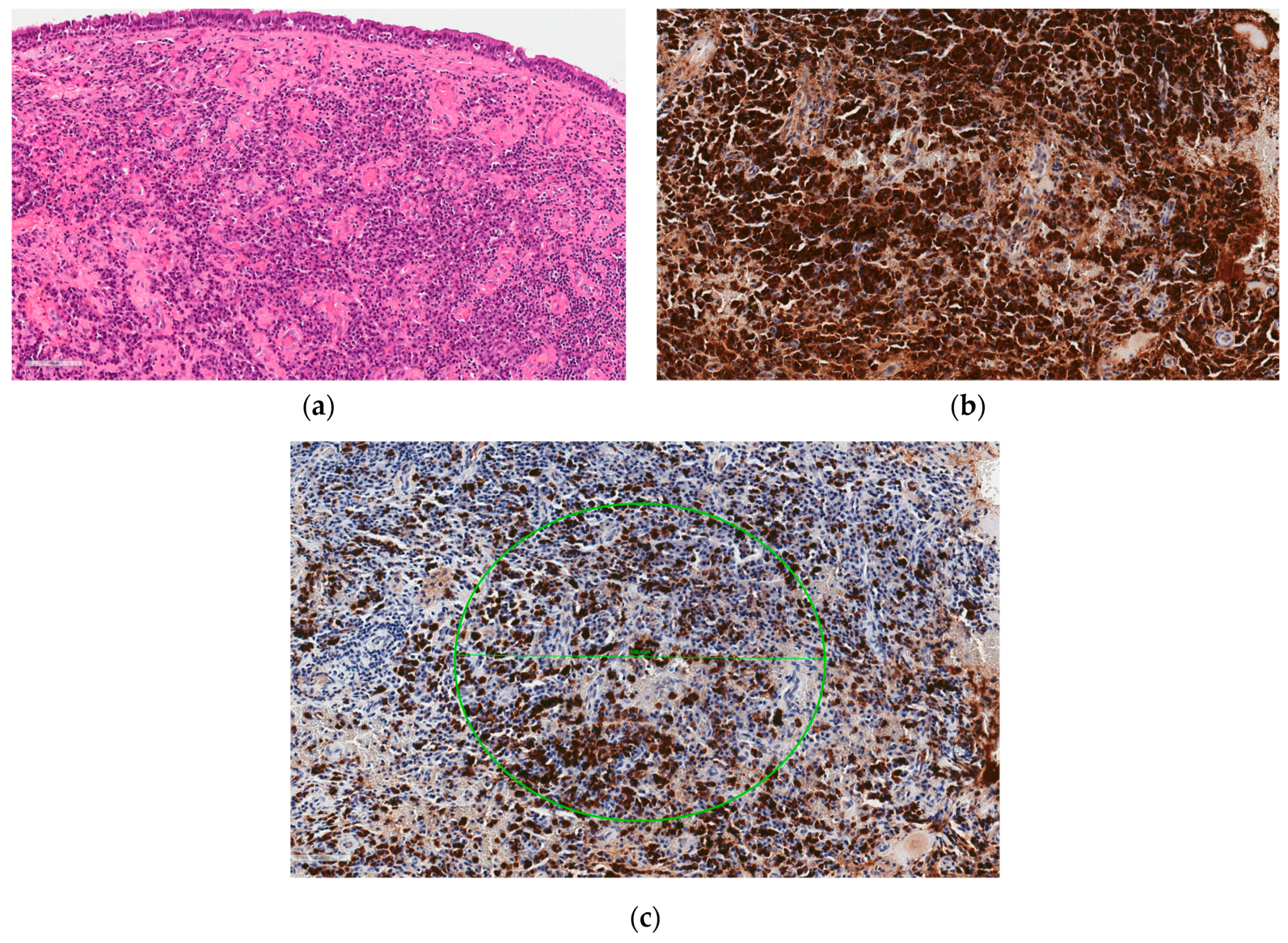 Medicina 60 00496 g002