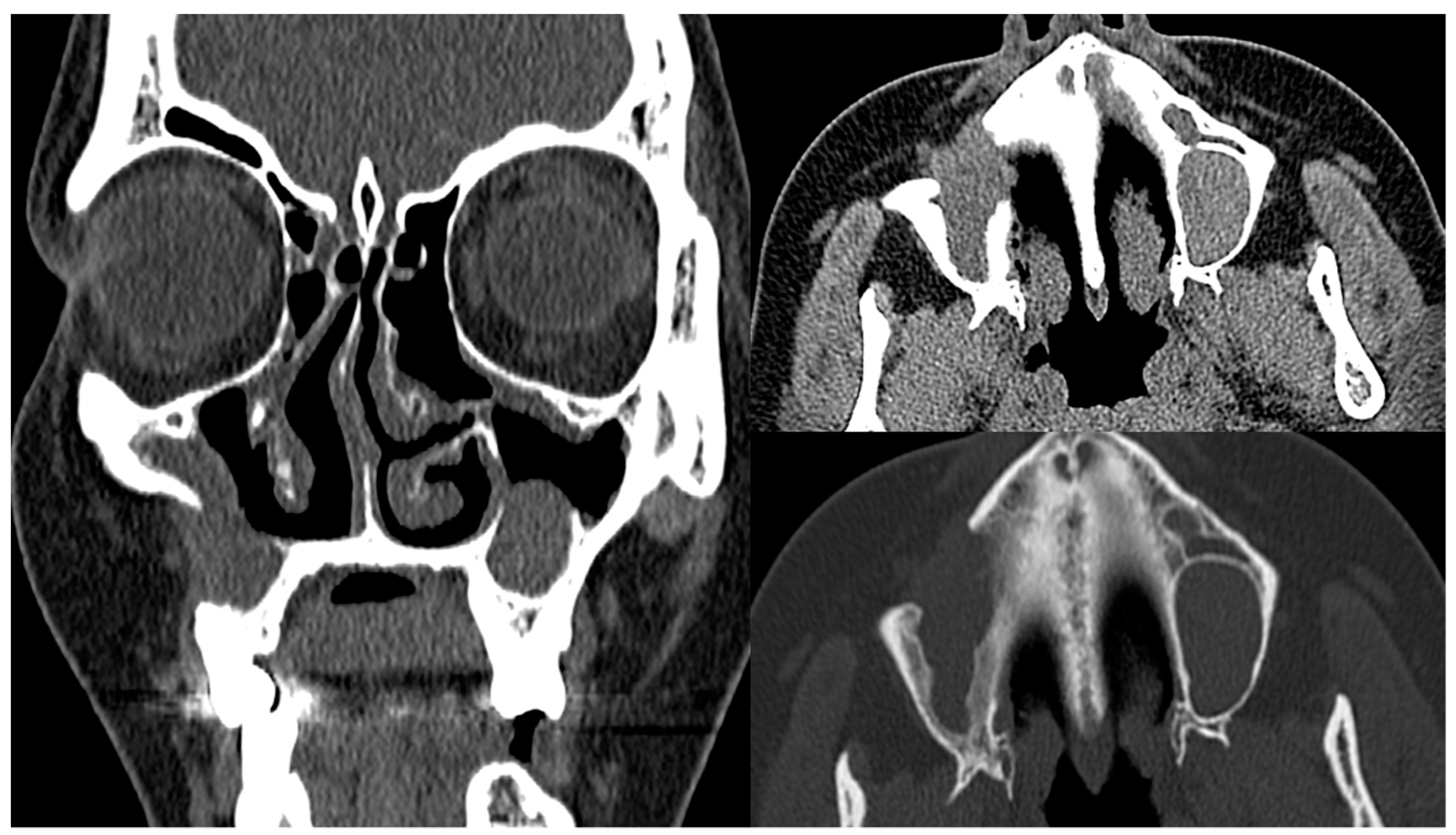 Medicina 60 00496 g003