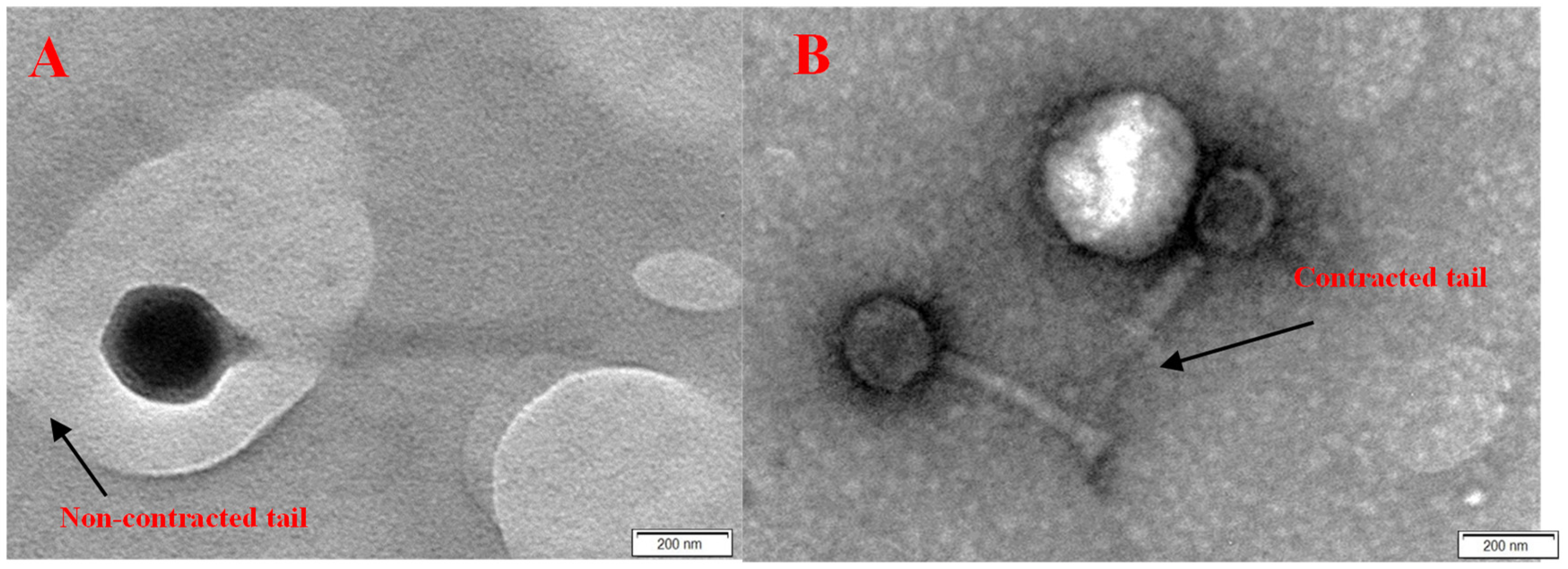 Medicina 60 00501 g004