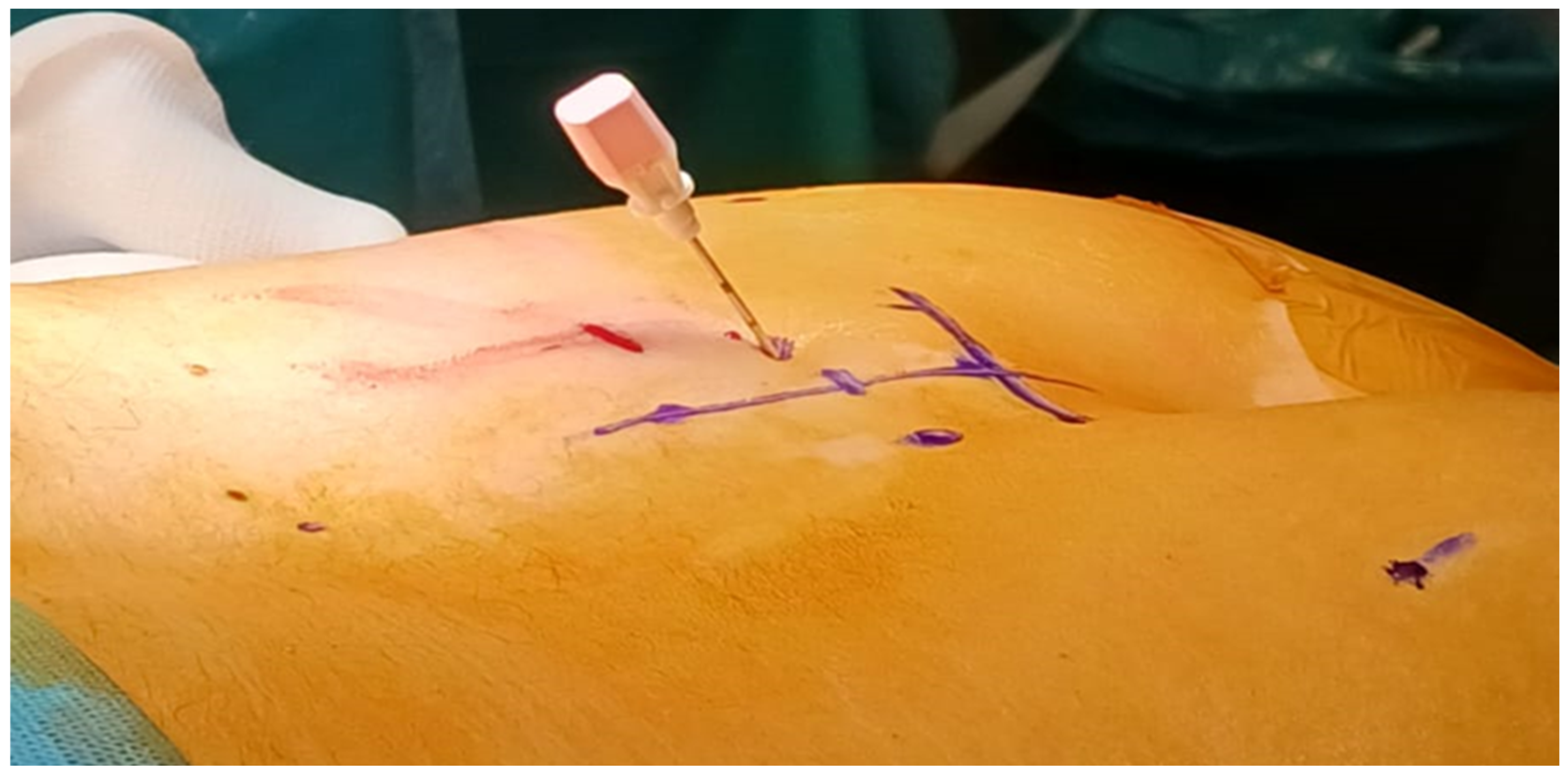 Medicina 60 00509 g002