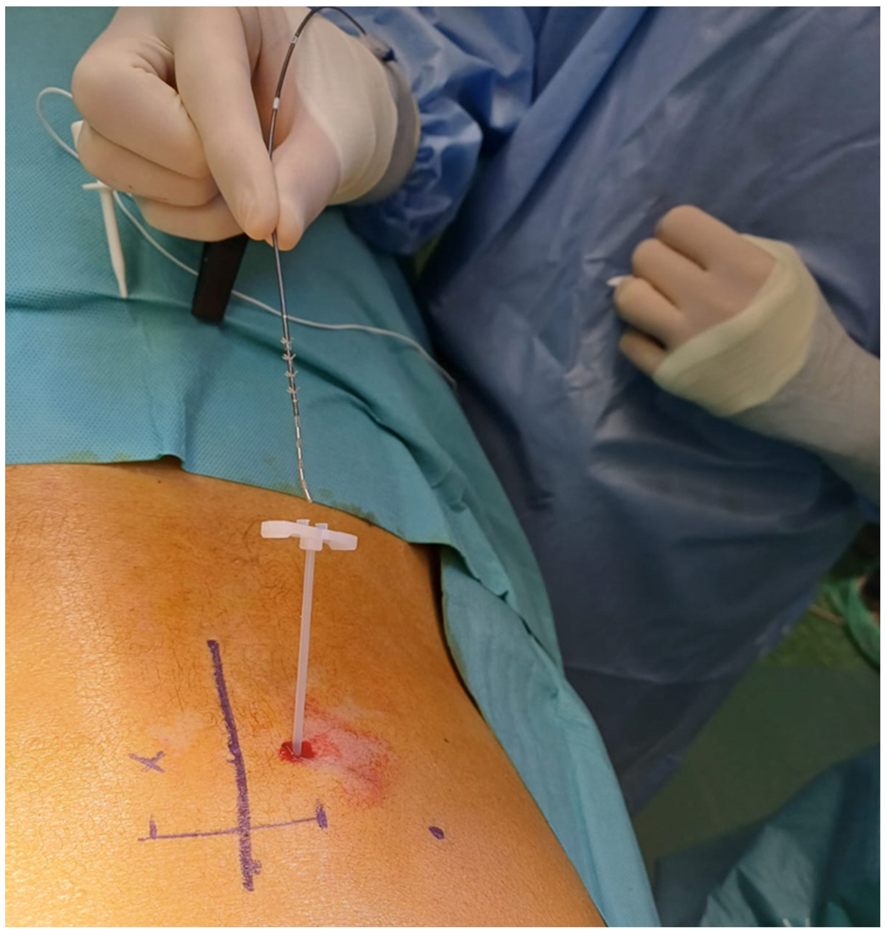 Medicina 60 00509 g003