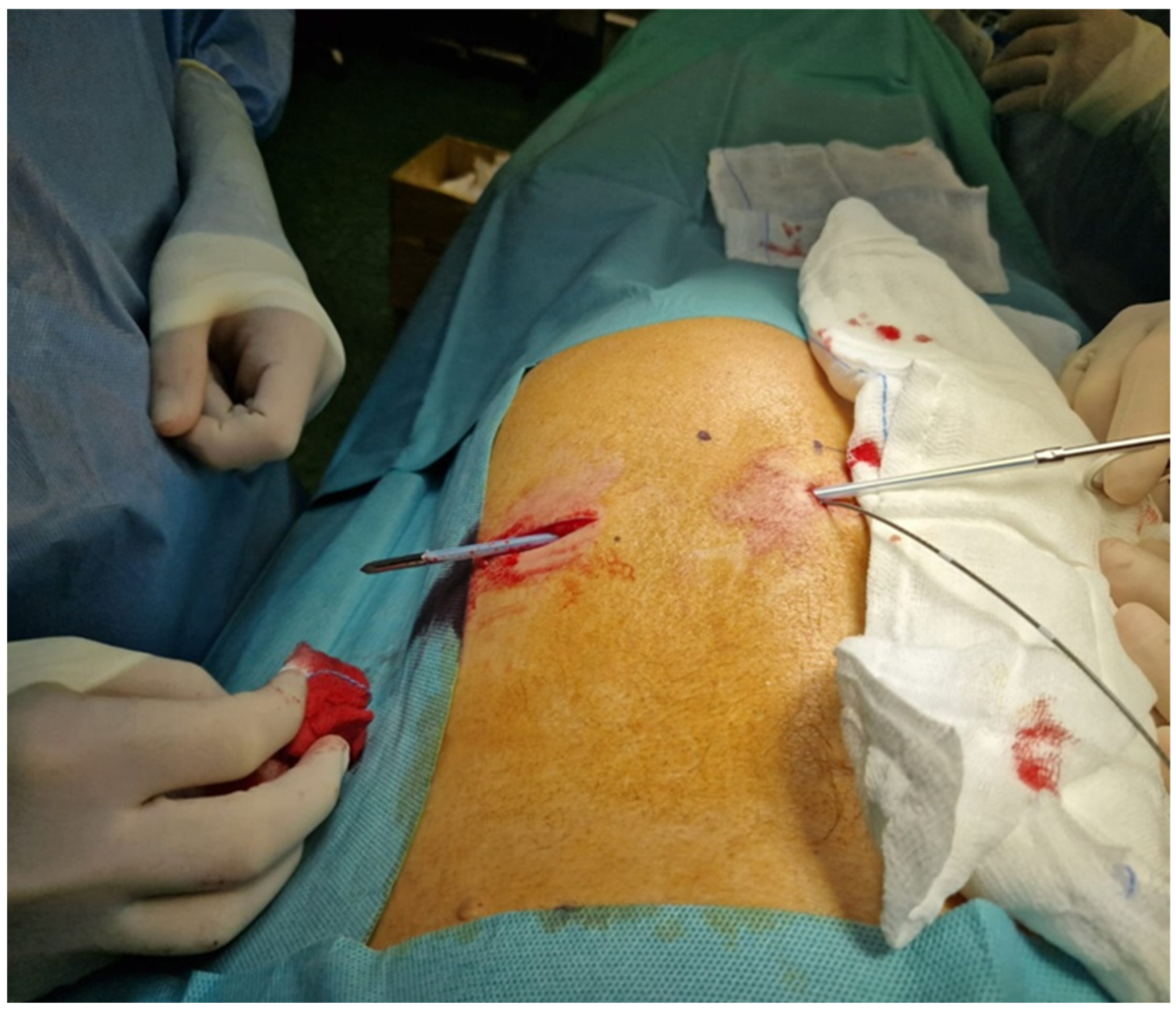 Medicina 60 00509 g004