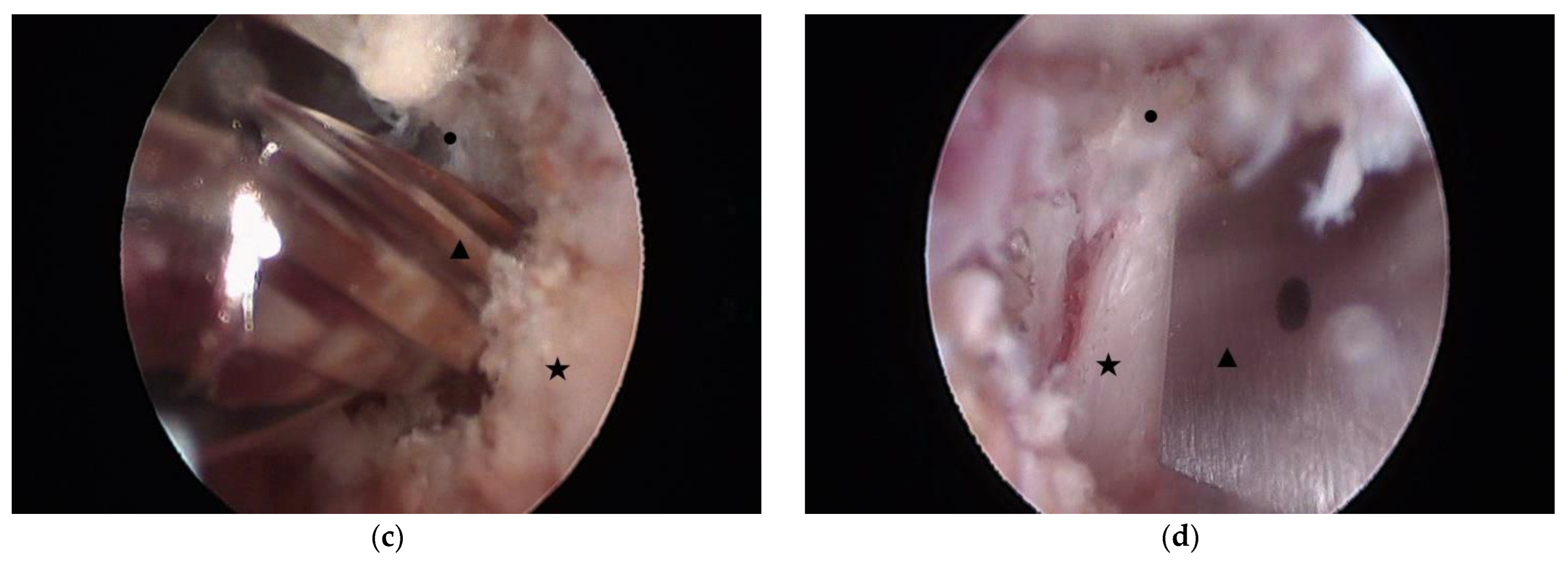 Medicina 60 00514 g002b