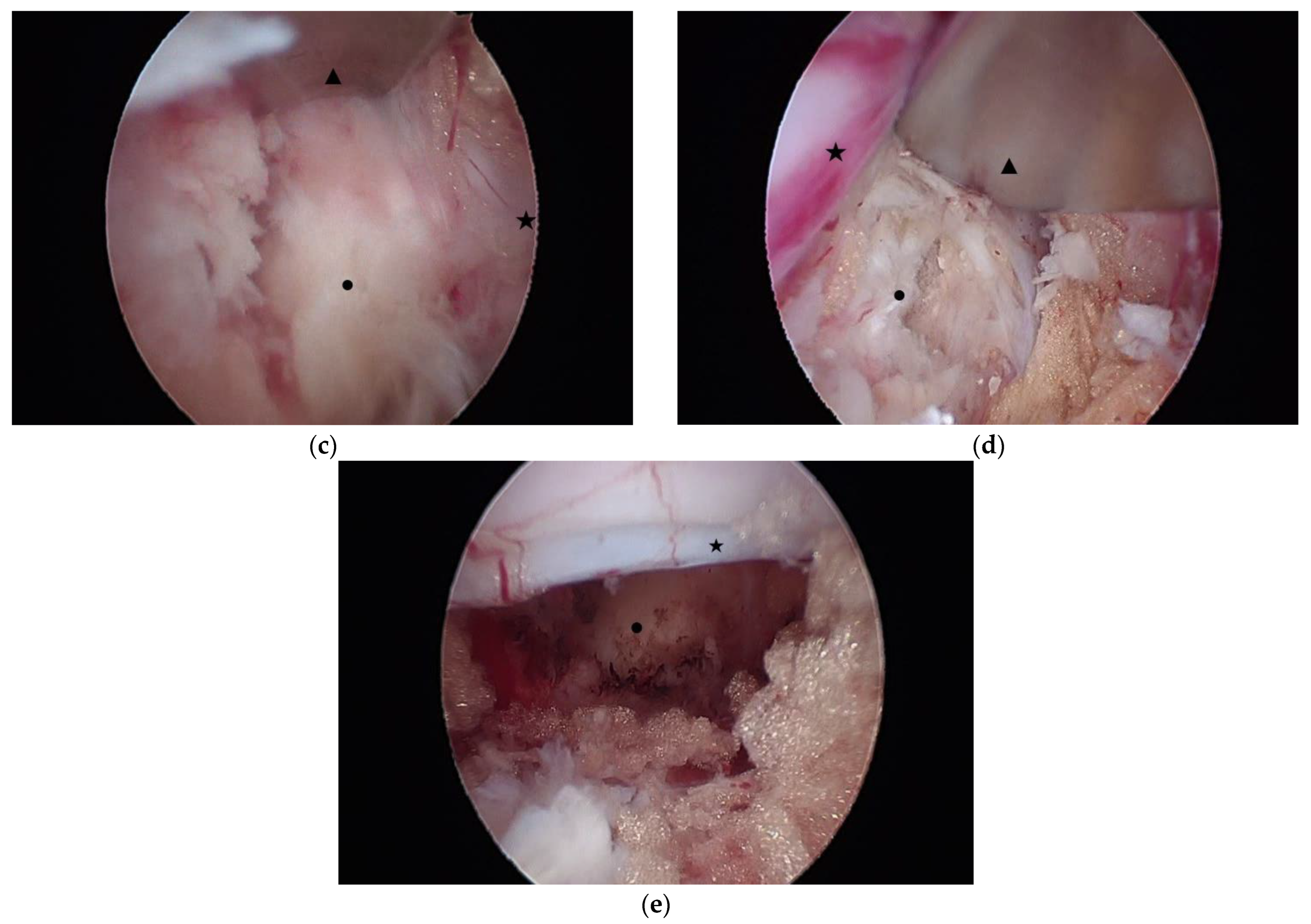 Medicina 60 00514 g003b