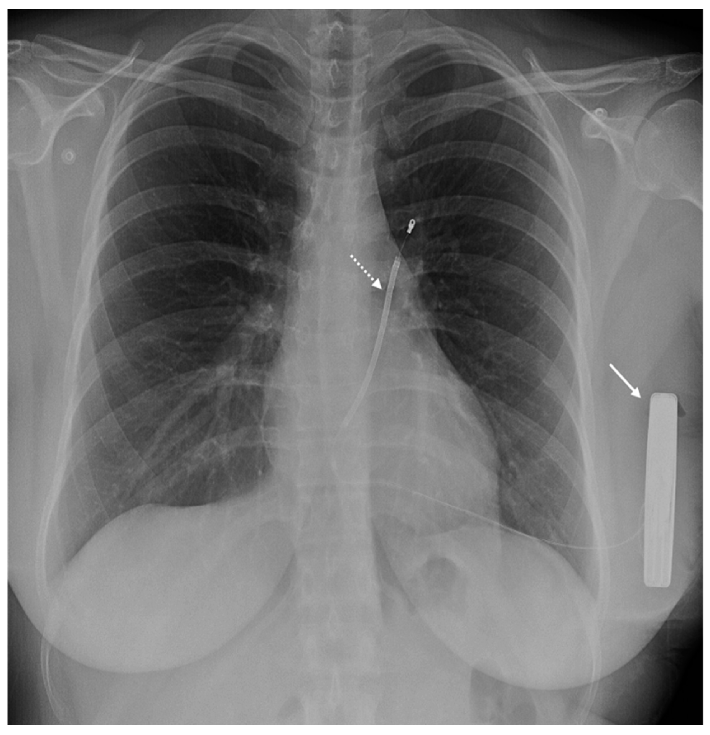 Medicina 60 00522 g003