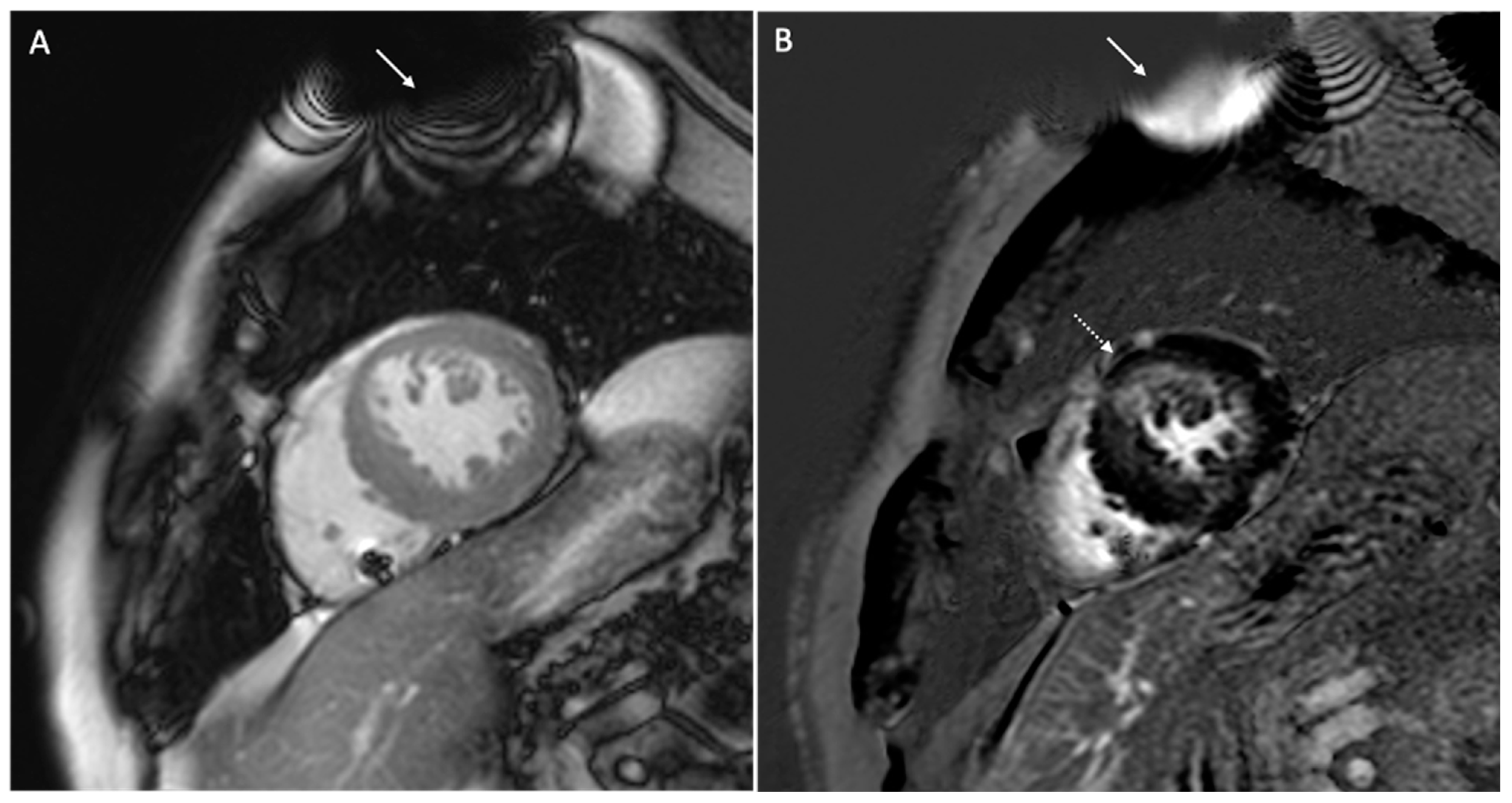 Medicina 60 00522 g006