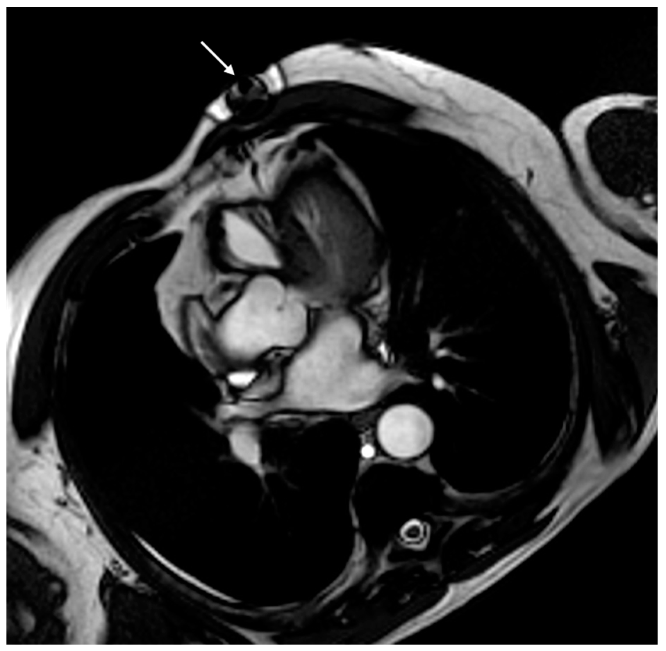 Medicina 60 00522 g007