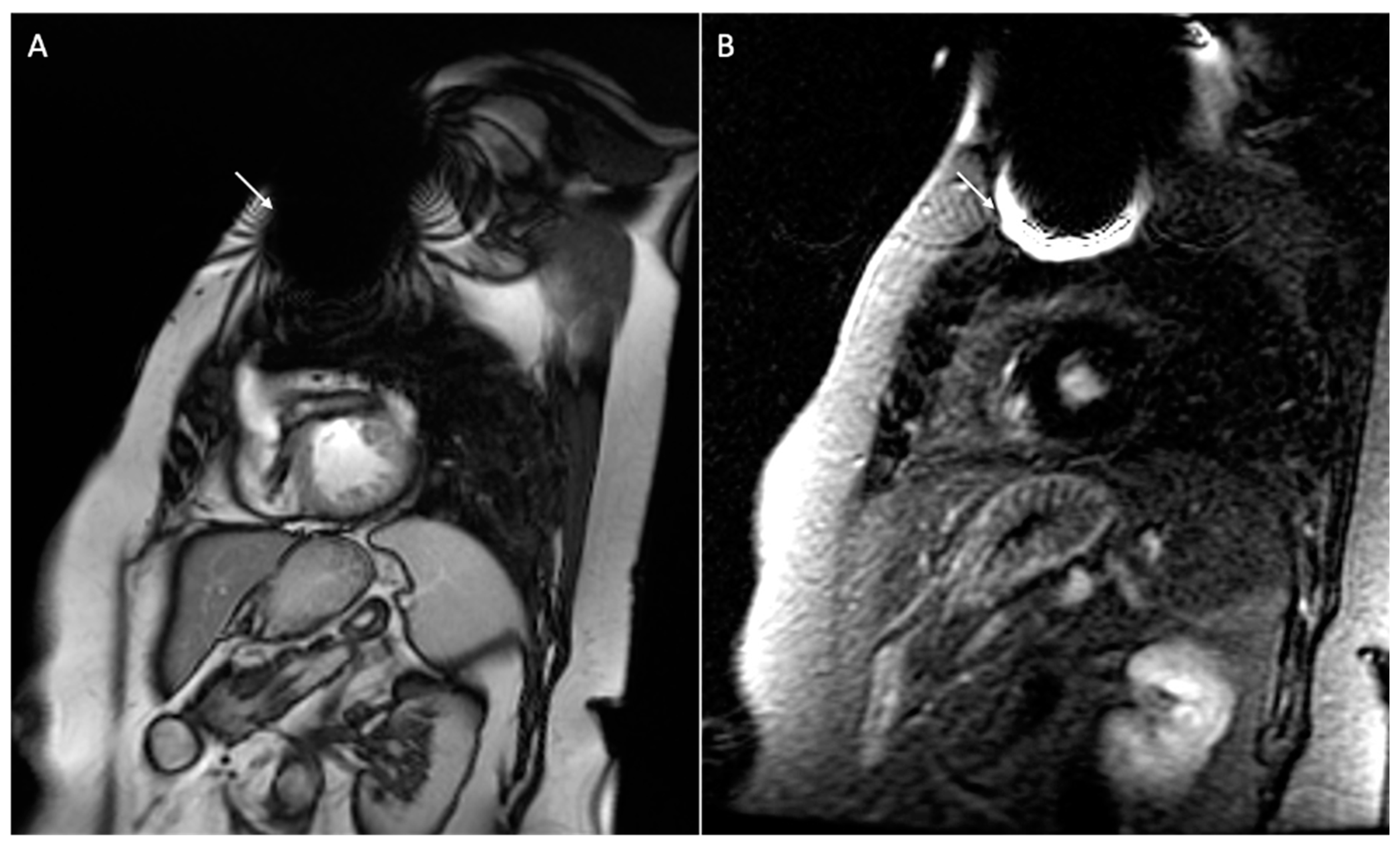 Medicina 60 00522 g008