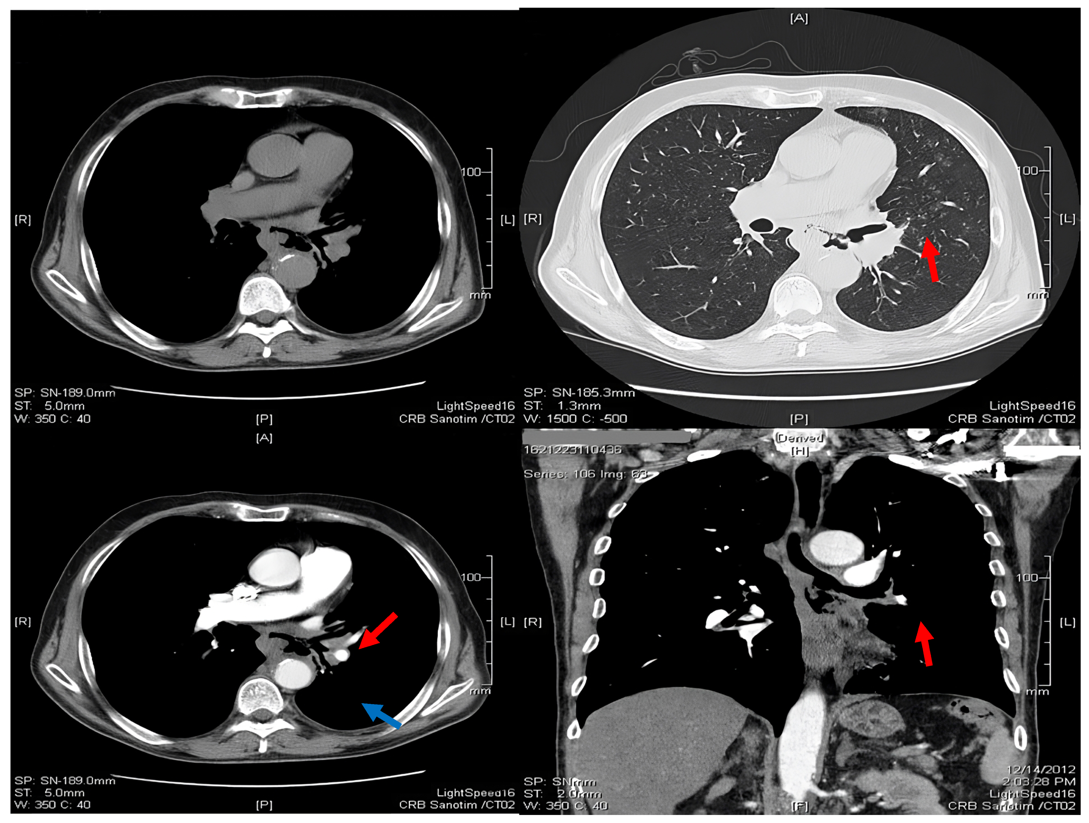 Medicina 60 00524 g002 Medicina 60 00524 g002