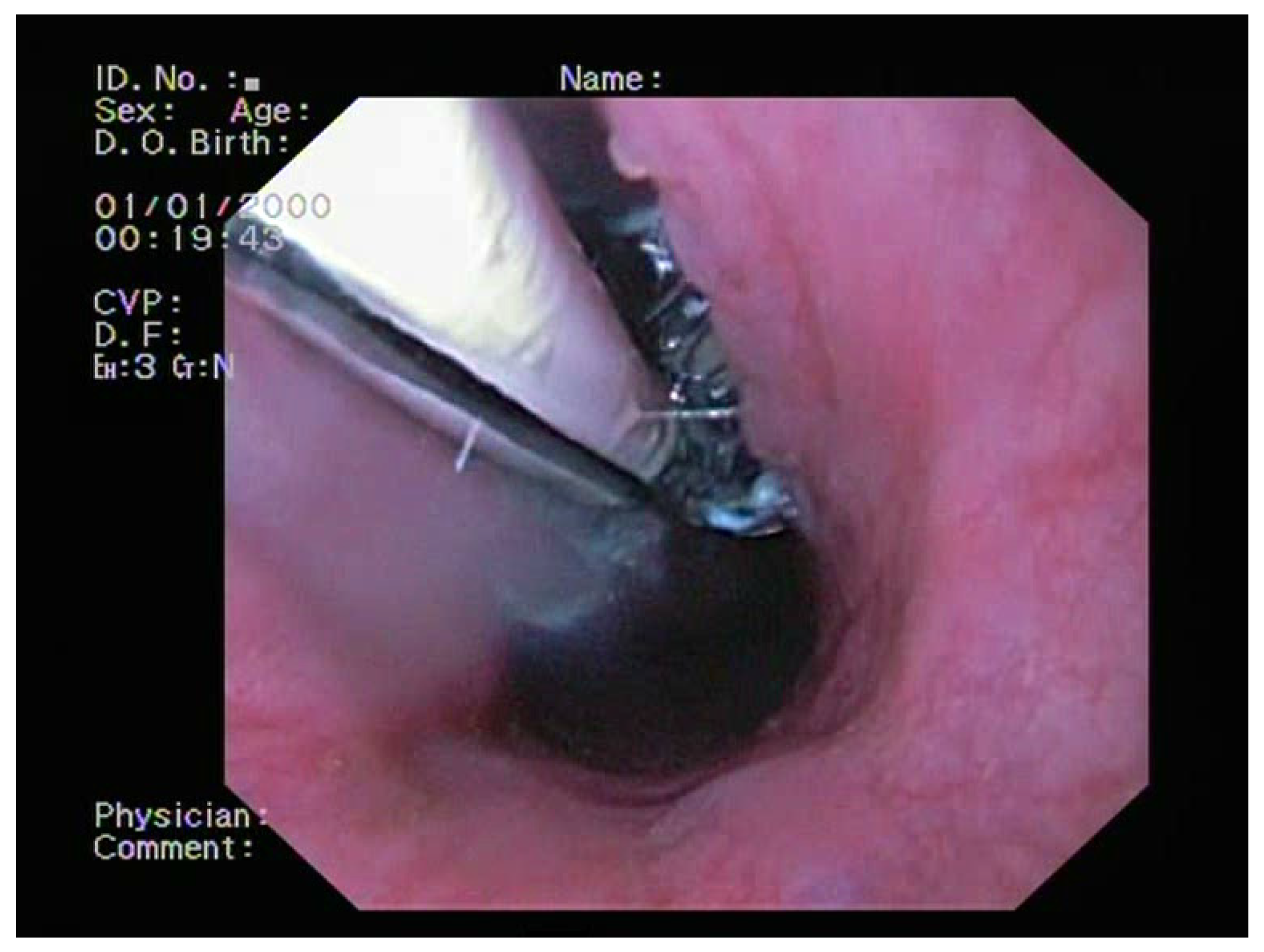 Medicina 60 00524 g005 Medicina 60 00524 g005