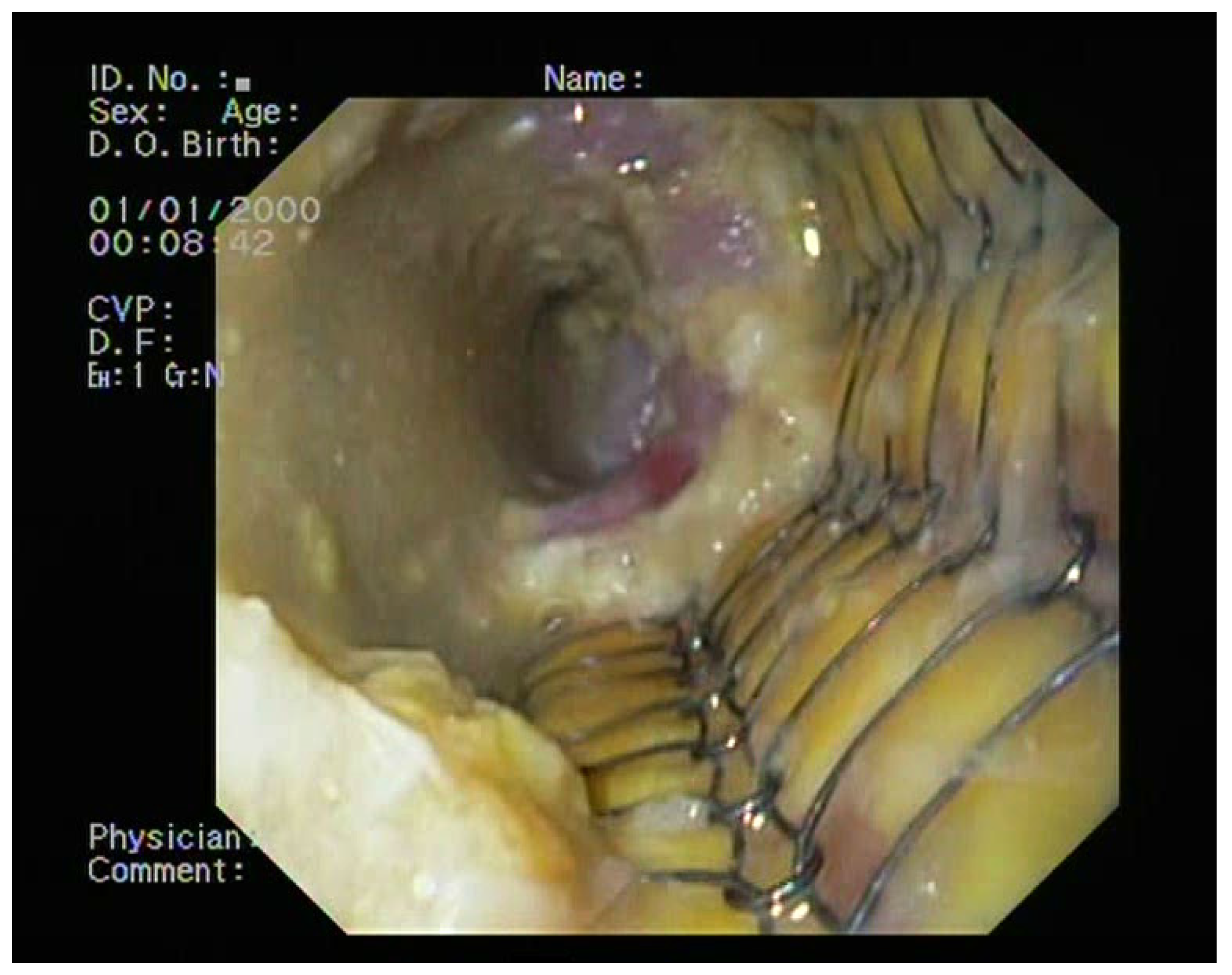 Medicina 60 00524 g006 Medicina 60 00524 g006