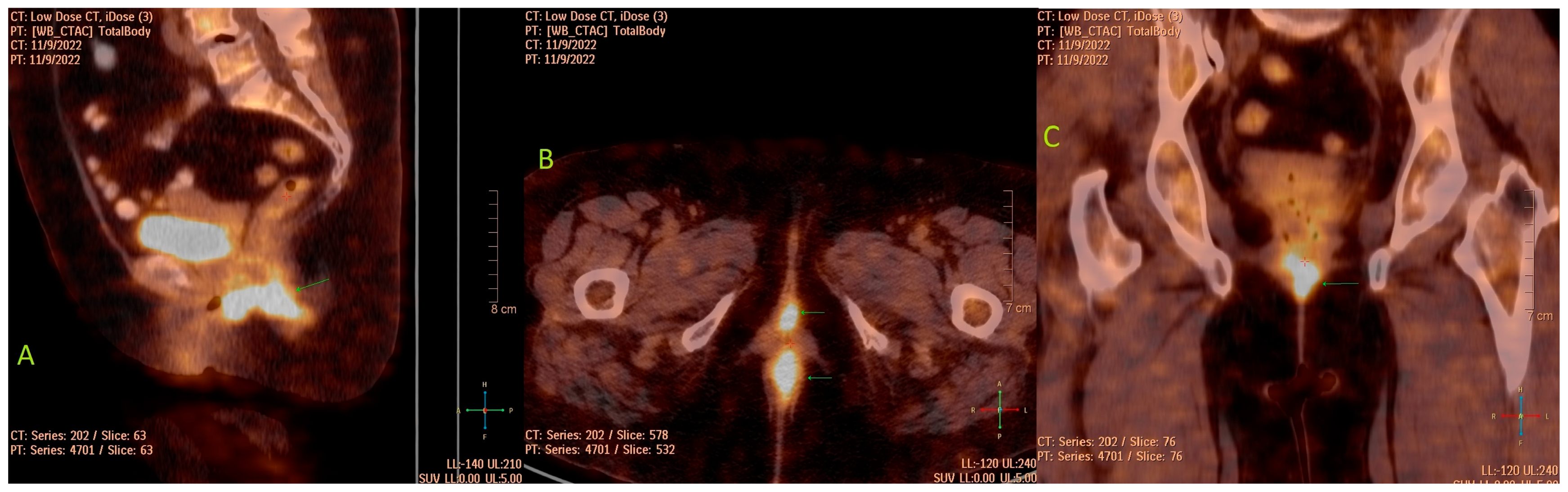 Medicina 60 00525 g002