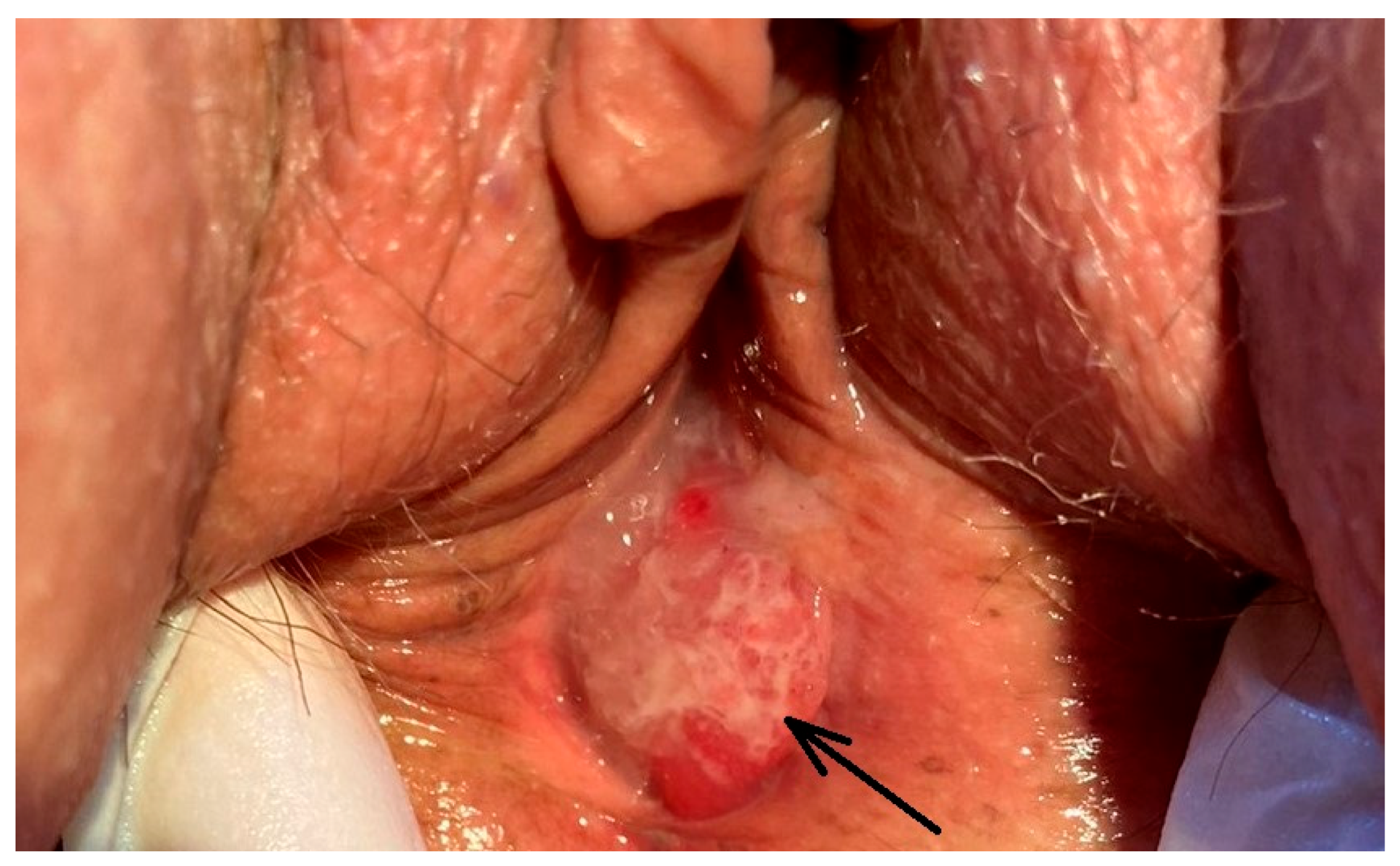 Medicina 60 00525 g003