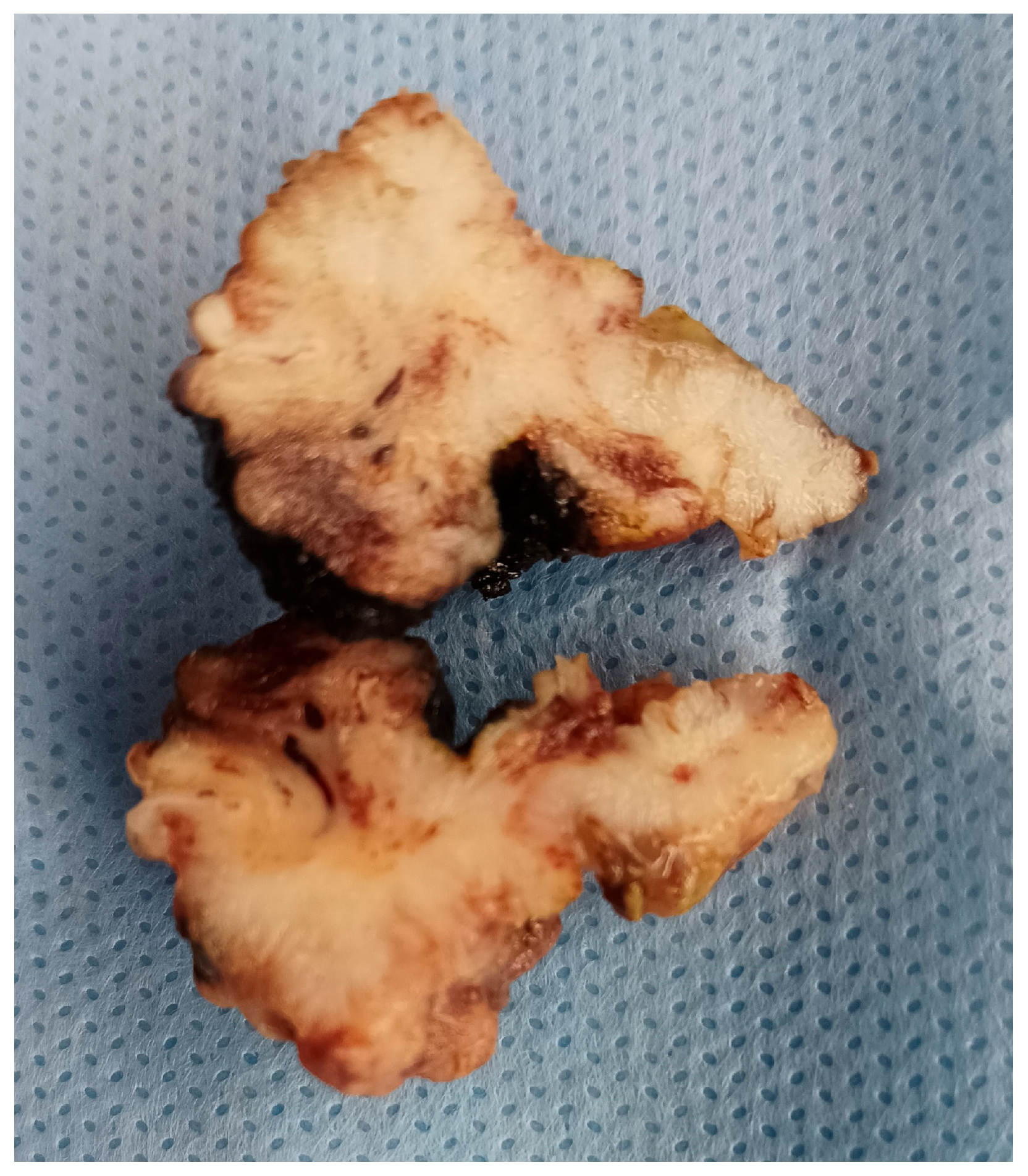 Medicina 60 00525 g004