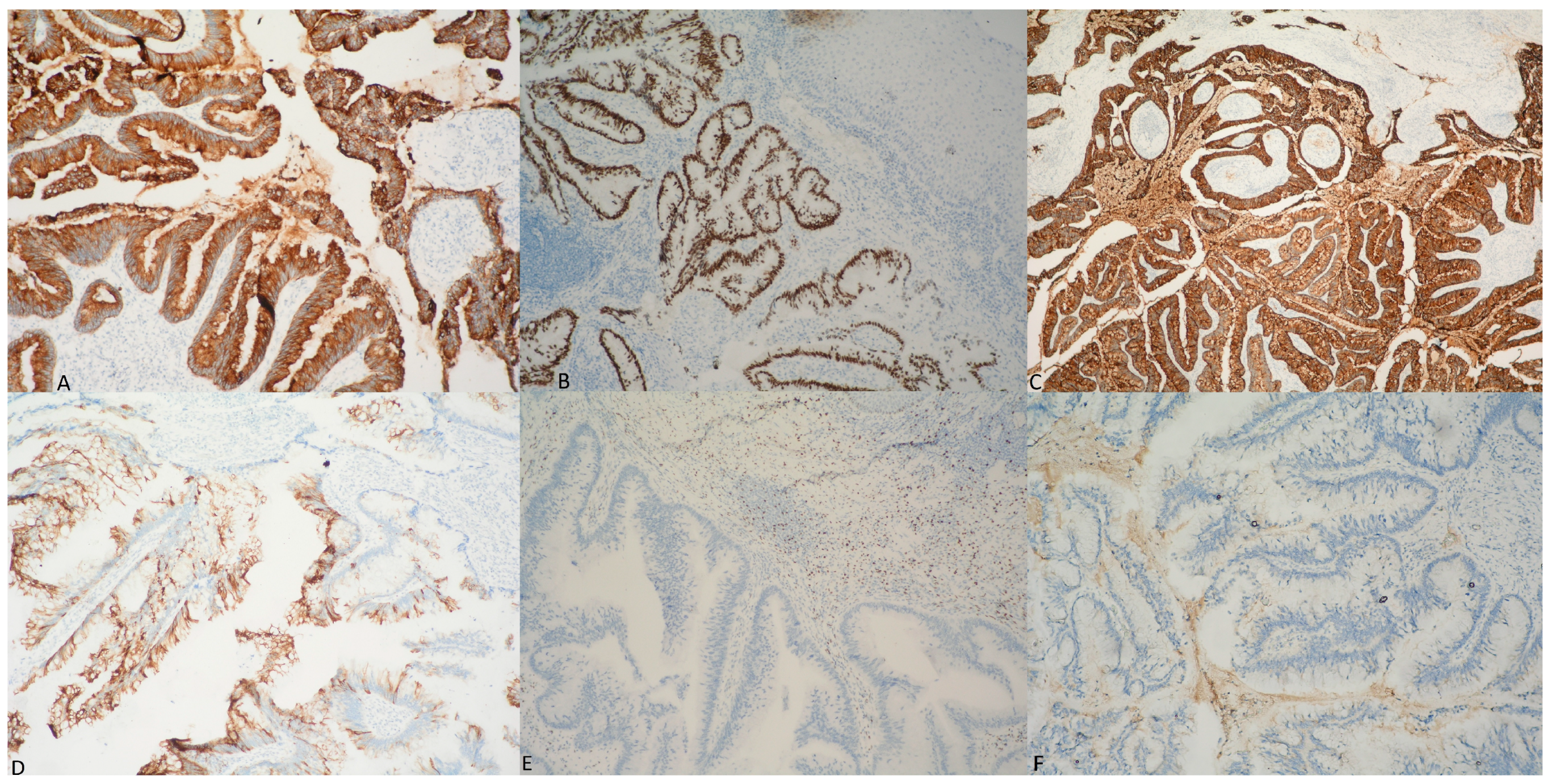 Medicina 60 00525 g006