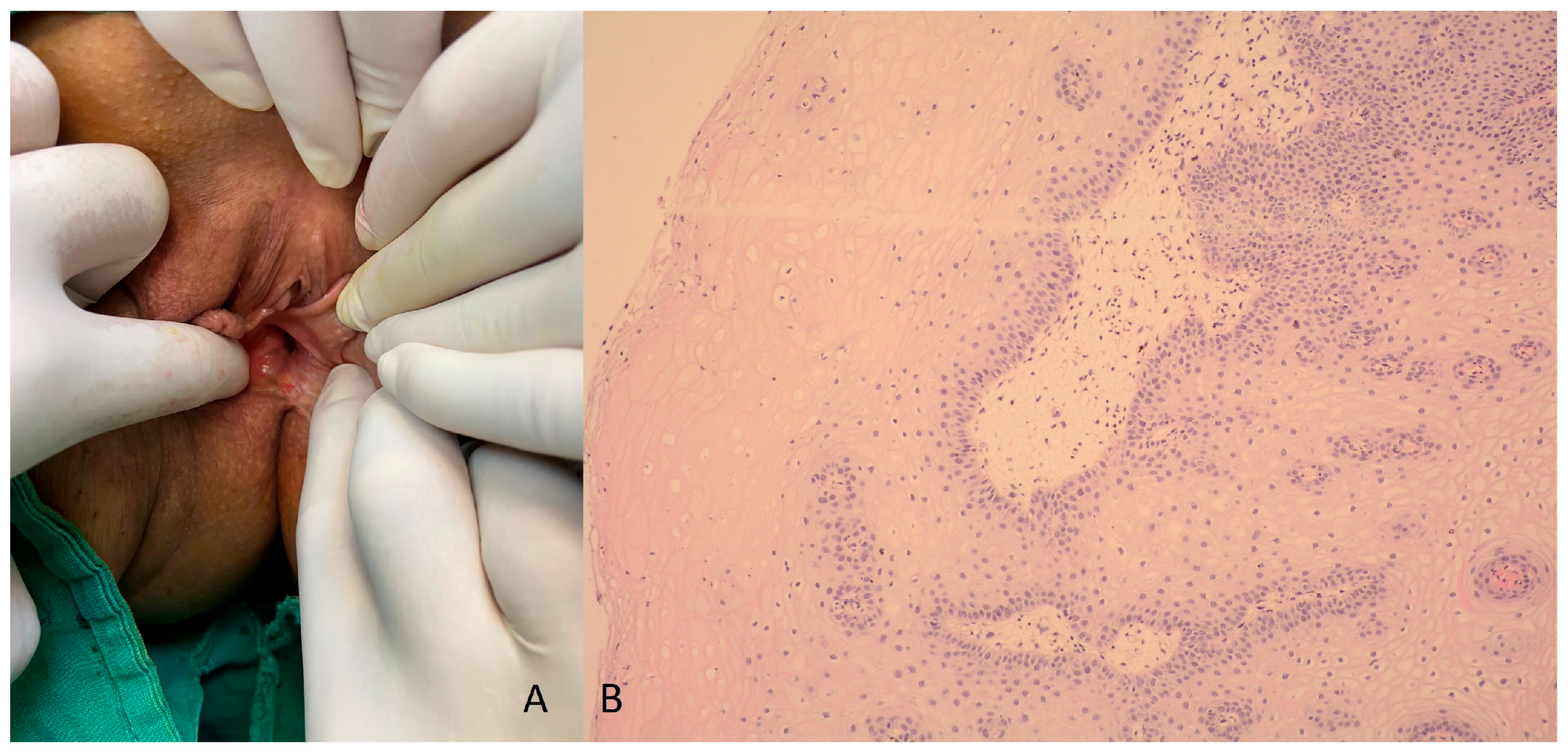 Medicina 60 00525 g007