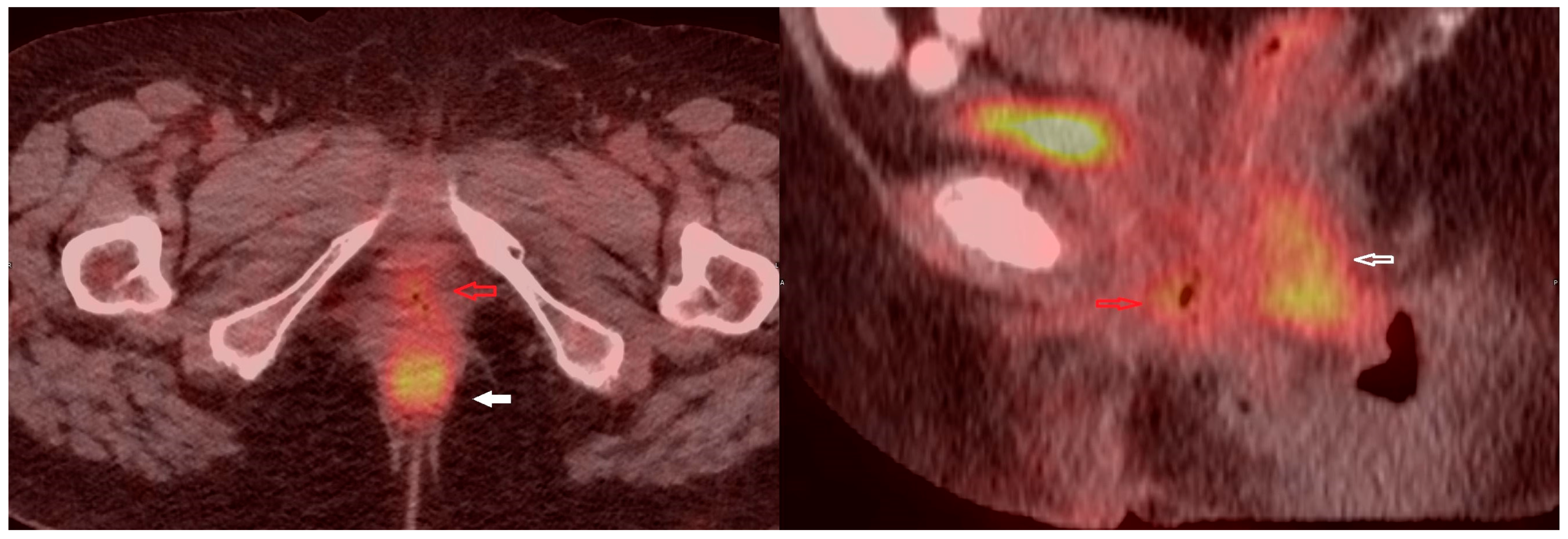 Medicina 60 00525 g008