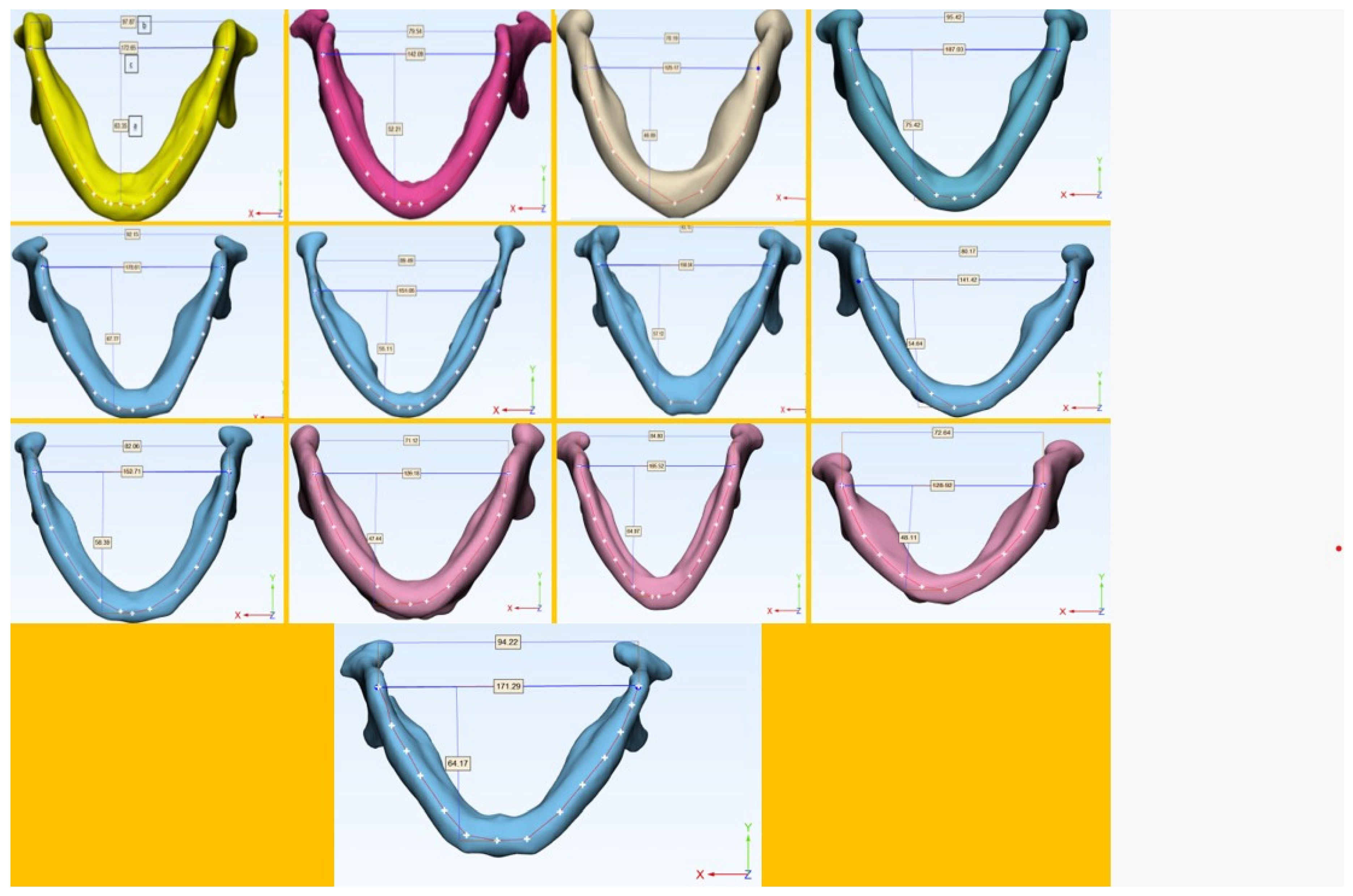 Medicina 60 00528 g001