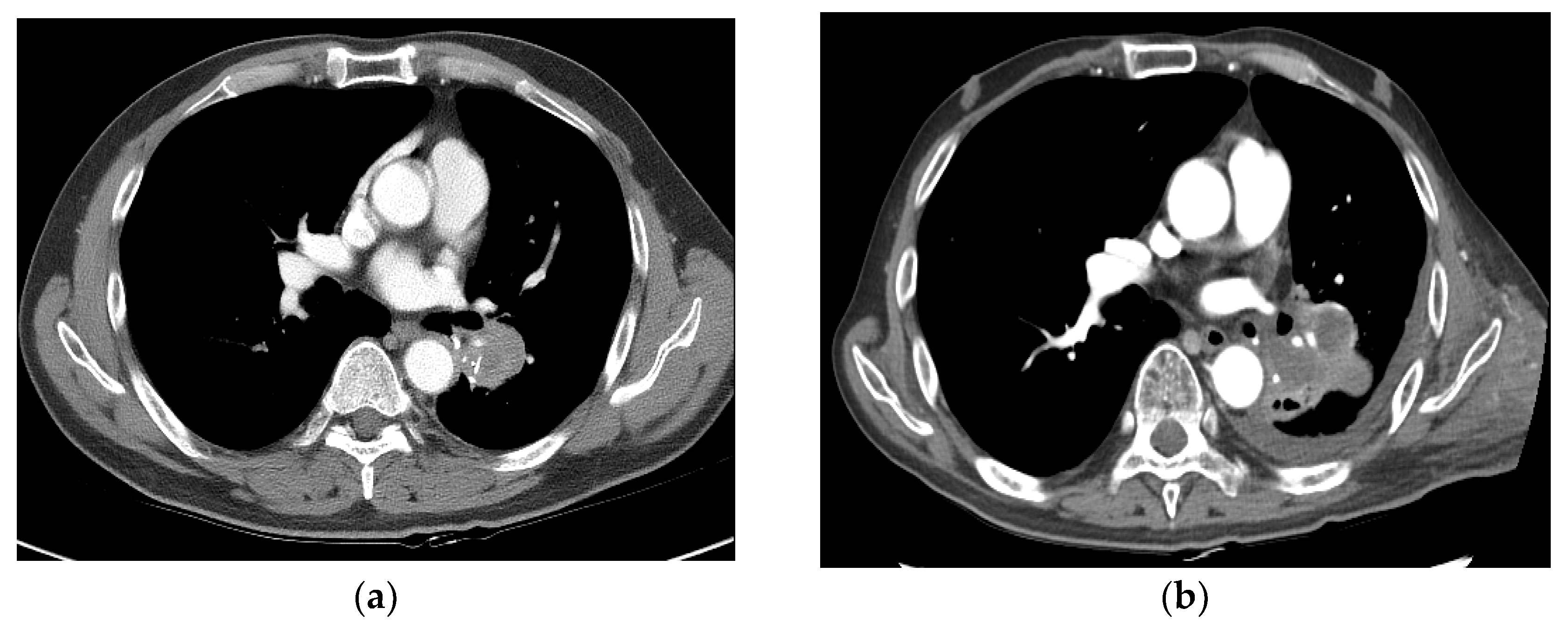 Medicina 60 00538 g004